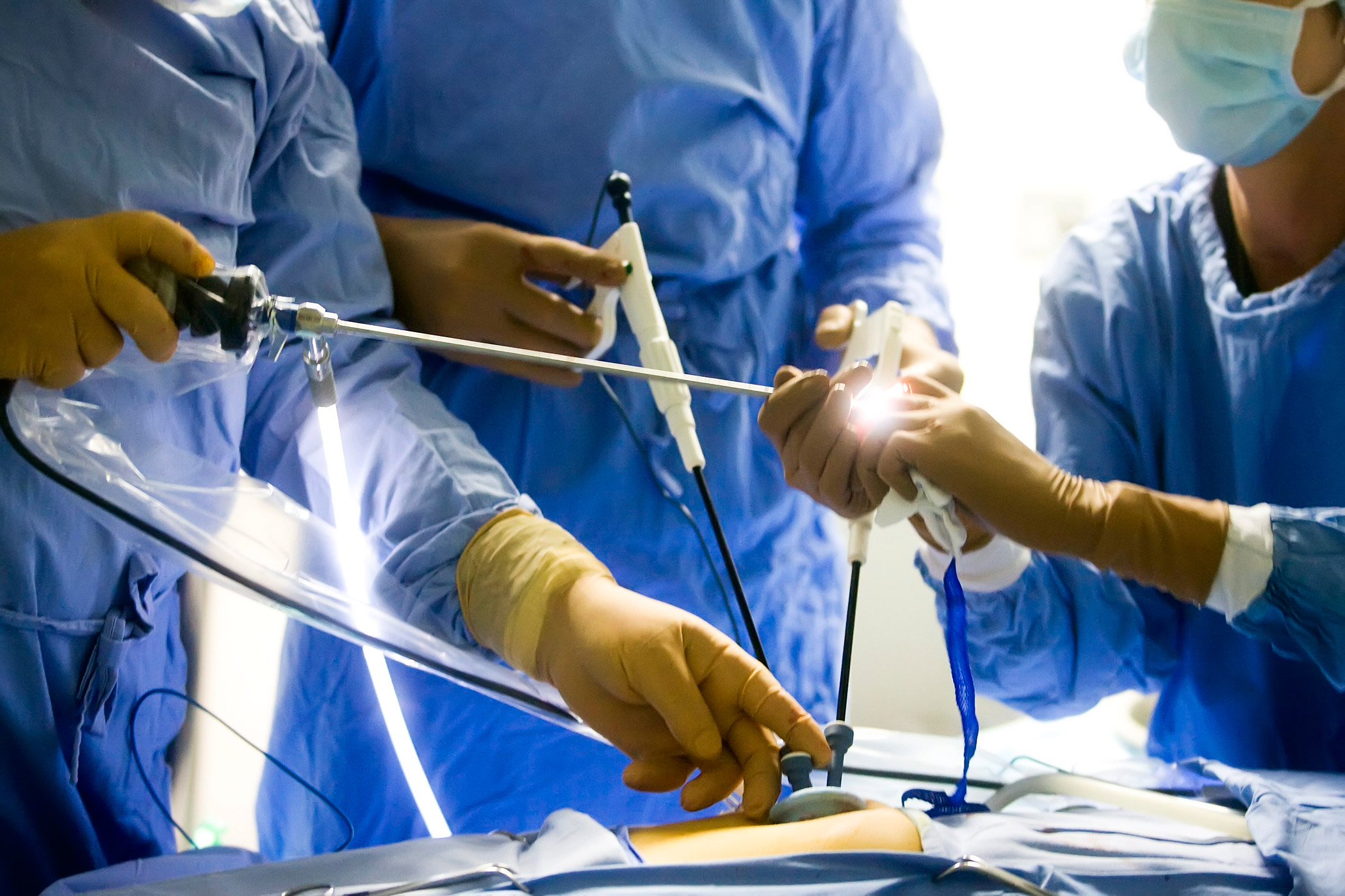 appendectomy