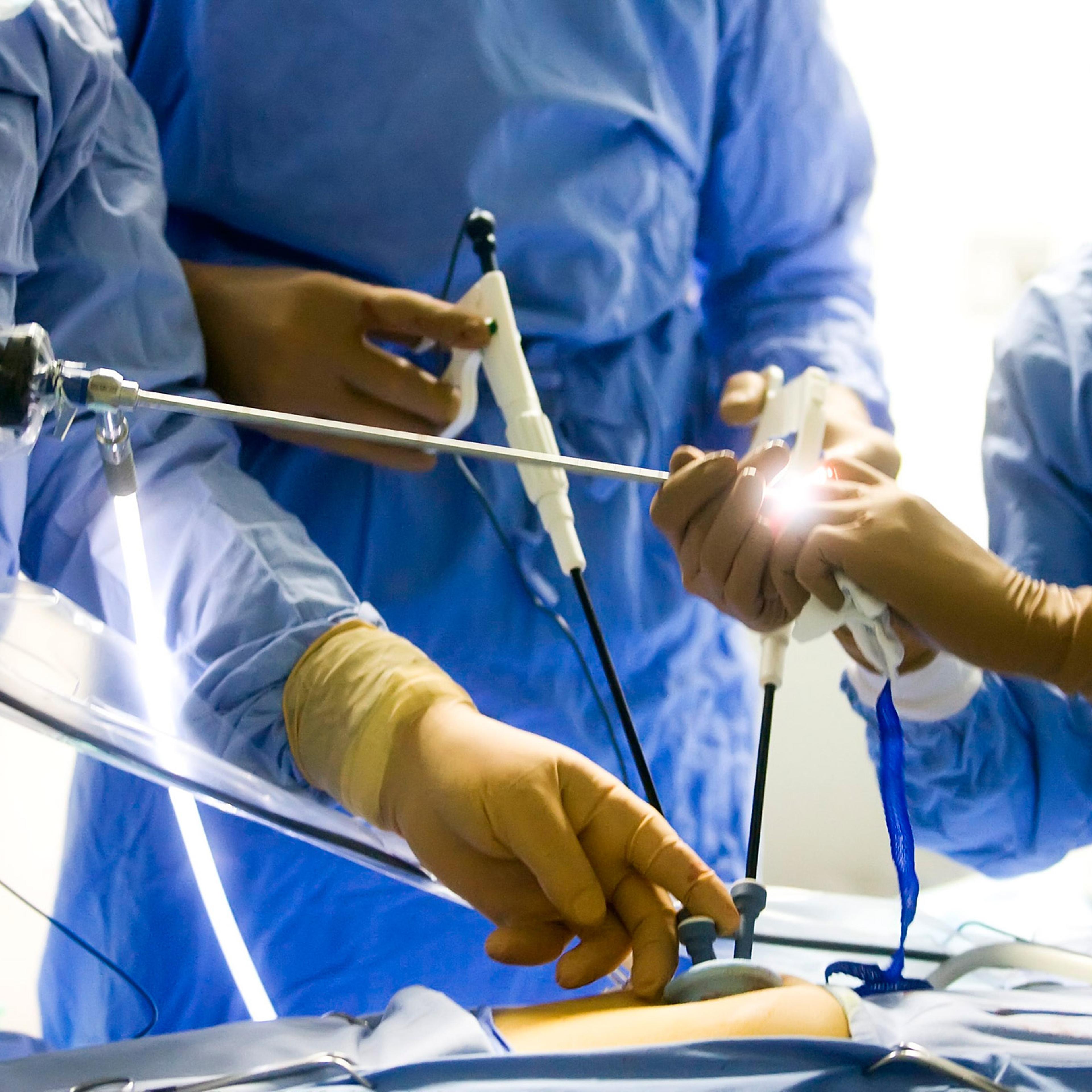 appendectomy