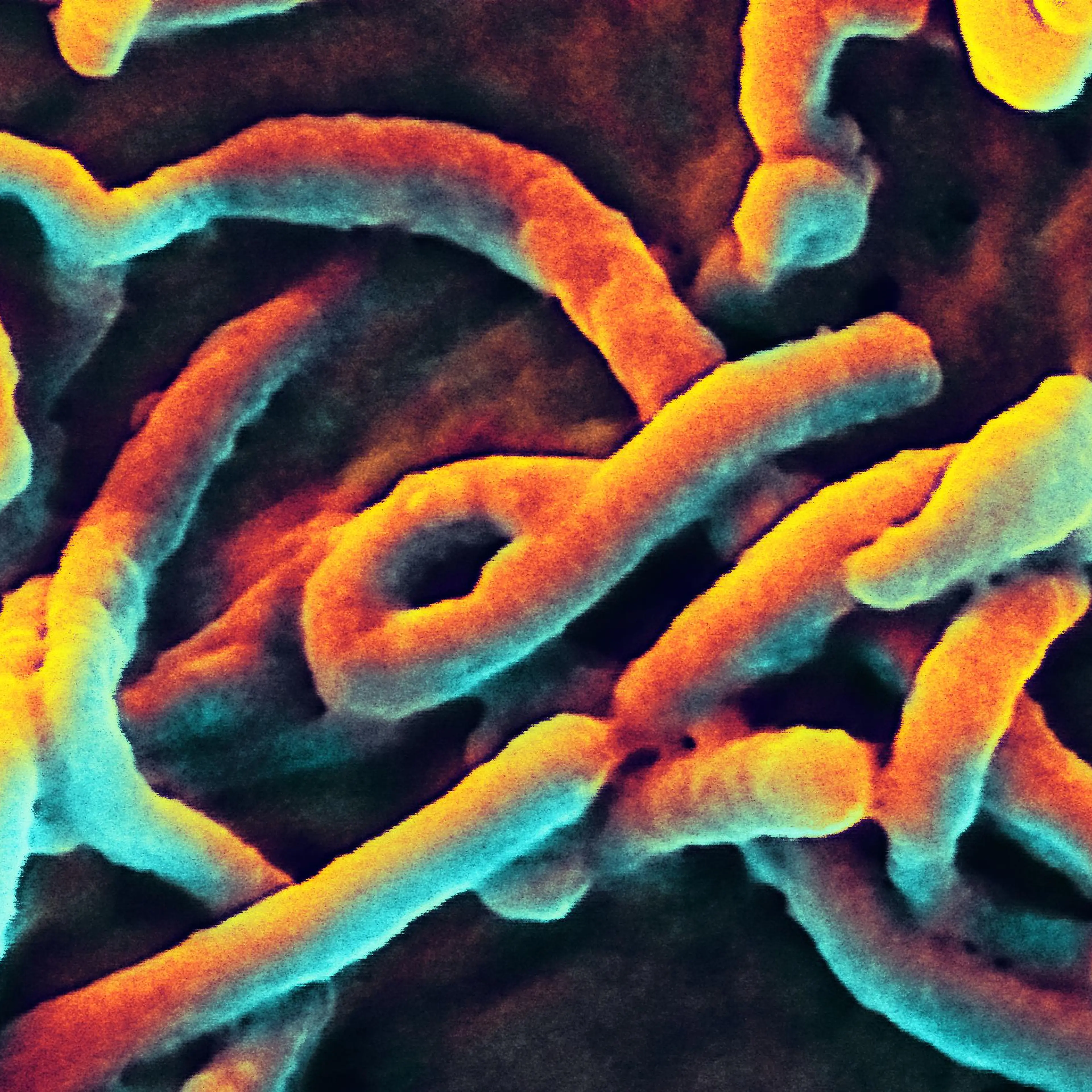 Electron micrograph of Ebola virus