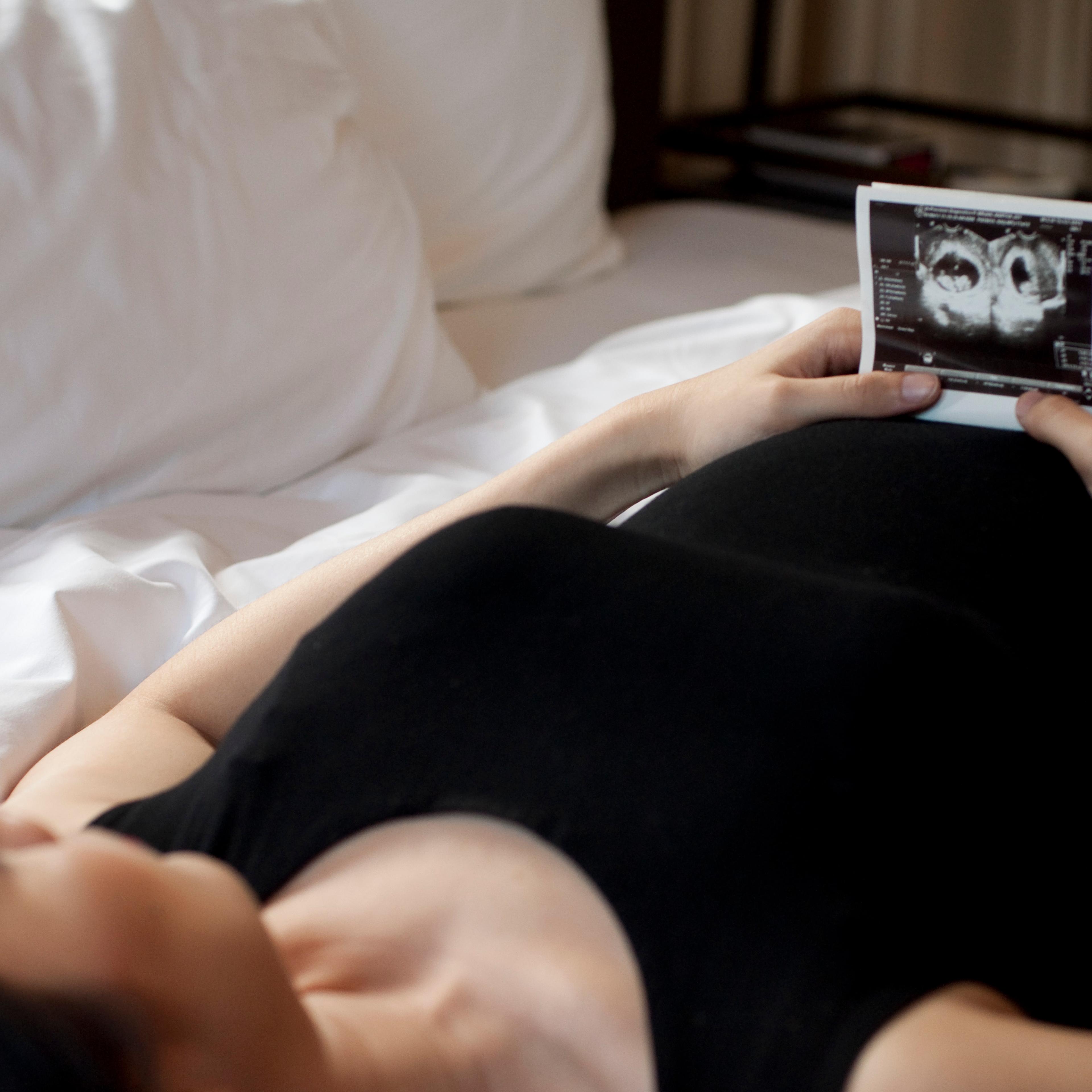 A woman in black dress is holding a sonogram of a baby