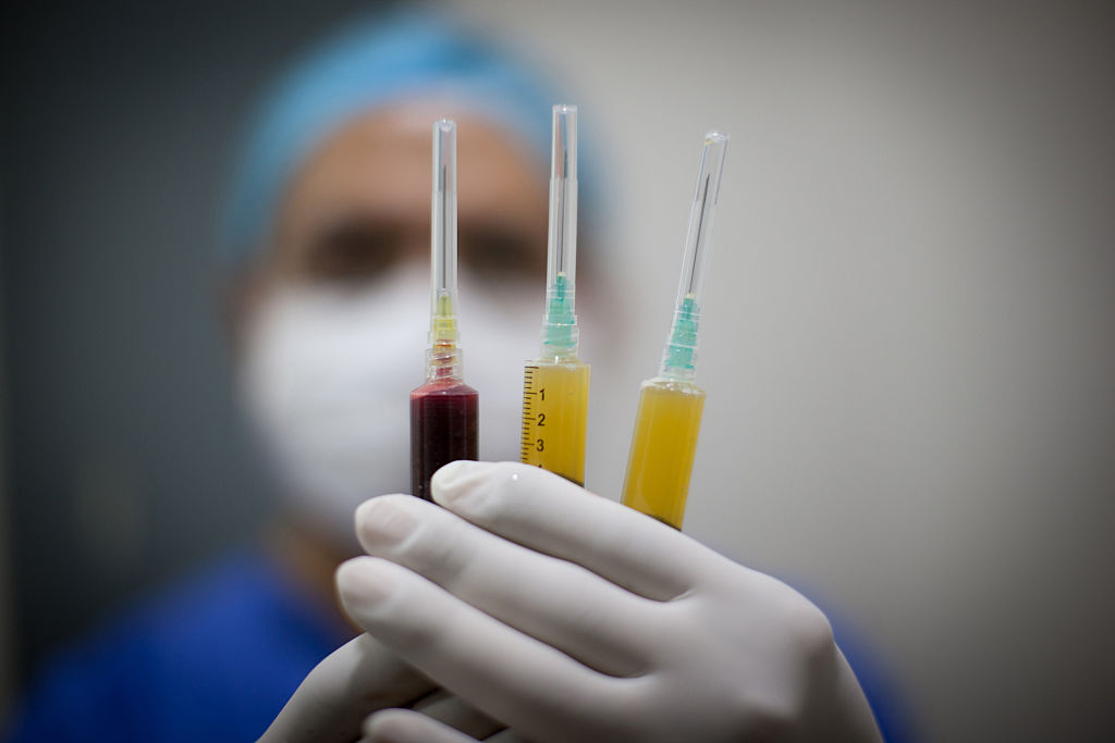 Stem cell clinic in Mexico City.