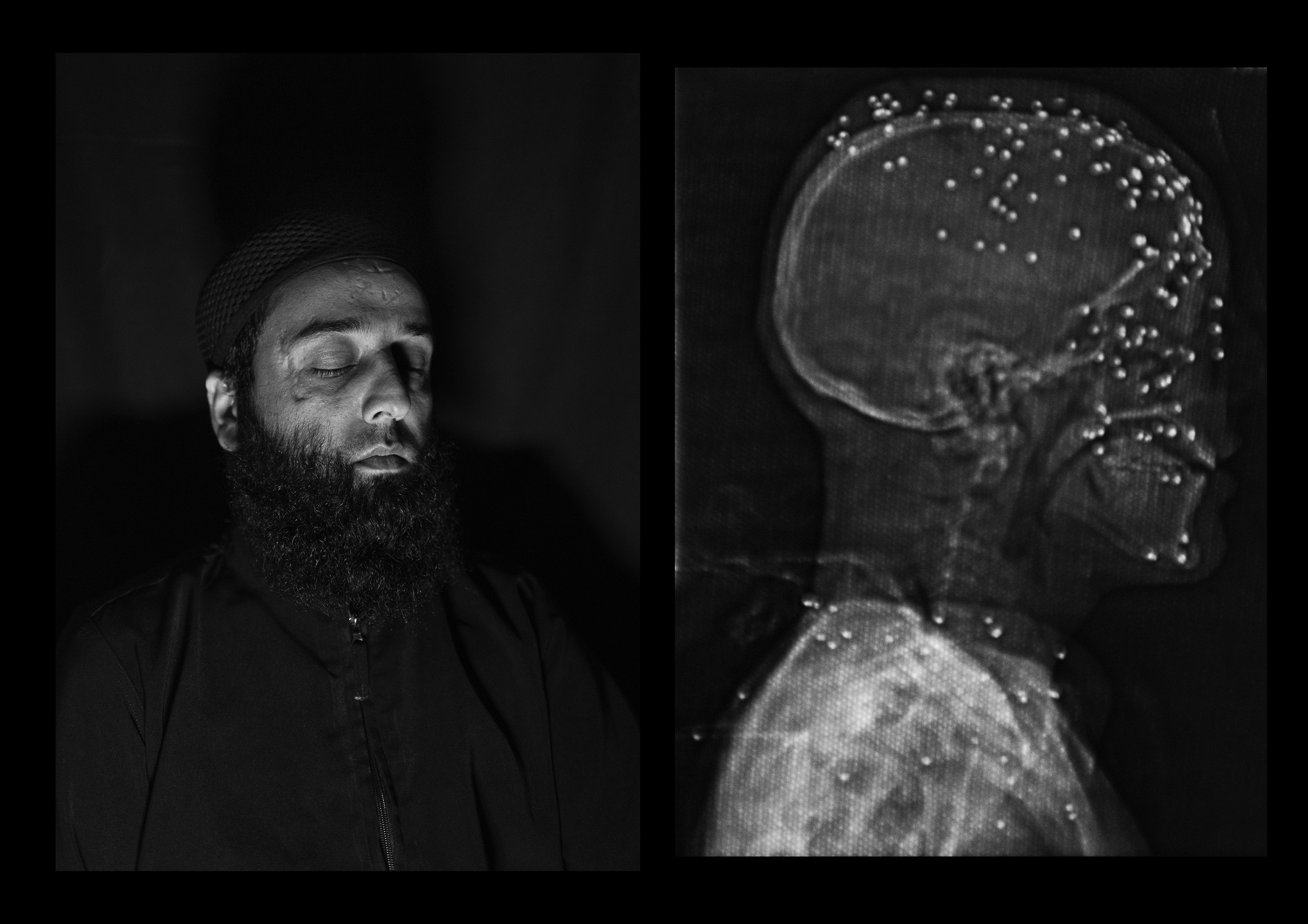 Amir Kabir Beigh, 26 years old, Baramulla. “I have gone through a lot of surgeries all over India but I am still completely blind".