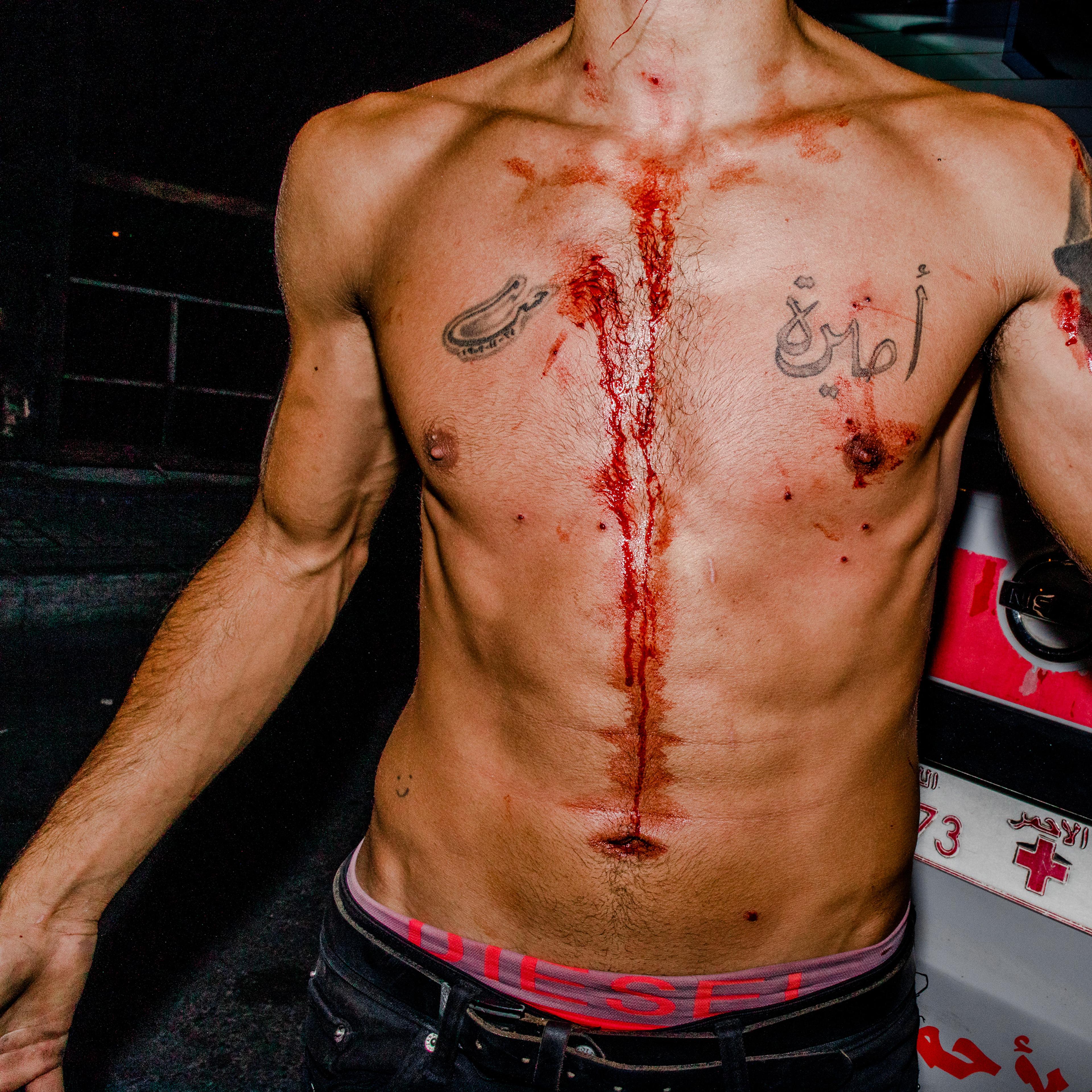 A man who was wounded during a demonstration on Aug. 11. At protests since the blast, researchers with Human Rights Watch have observed birdshot pellets being fired "indiscriminately" at protesters by security forces. After attacks on members of the pres