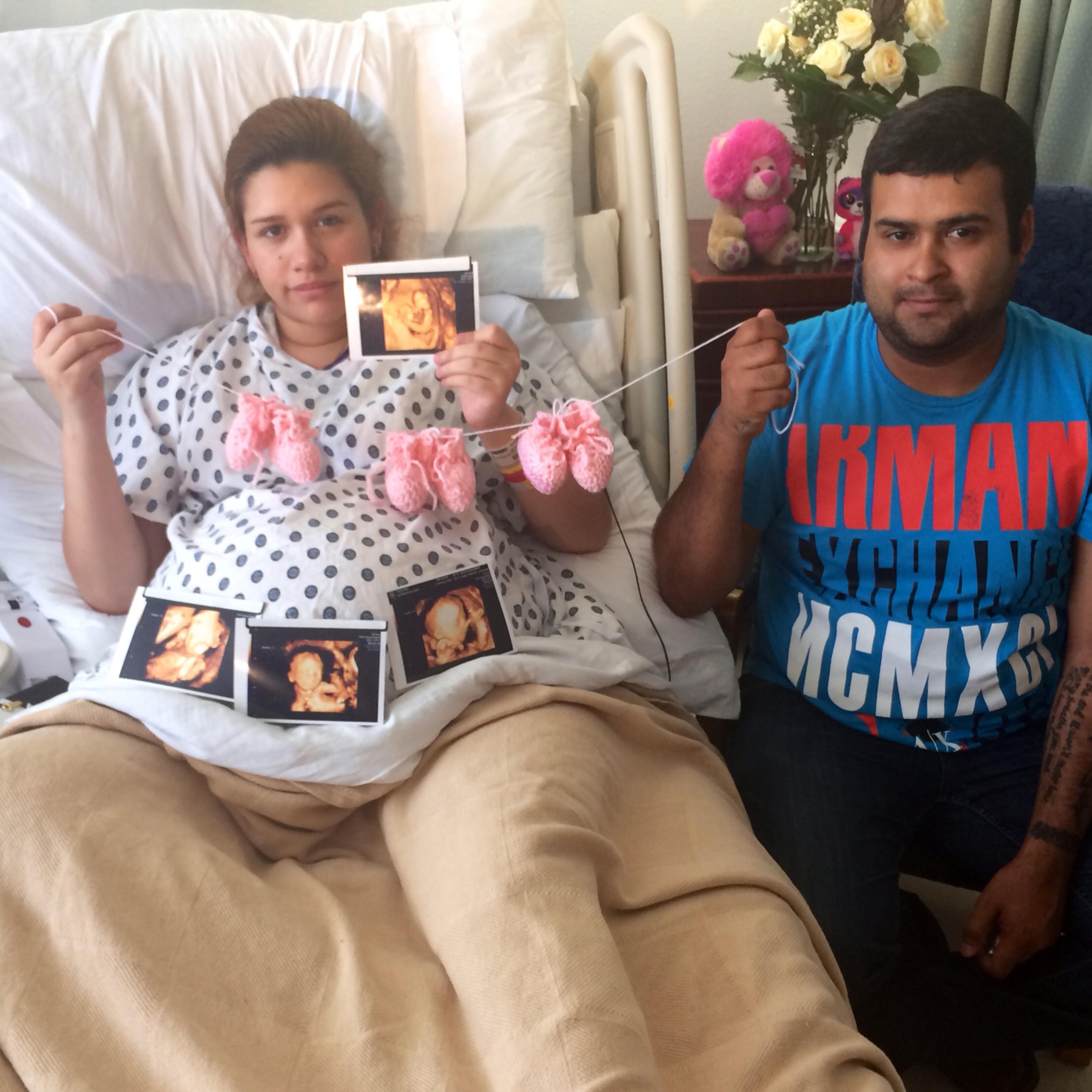 sylvia-hernandez-roel torres-triplets-conjoined