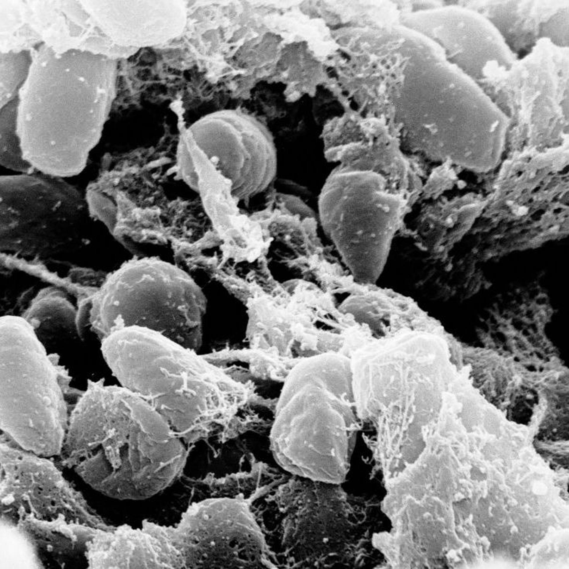 Scanning electron micrograph depicting a mass of Yersinia pestis bacteria (the cause of bubonic plague) in the foregut of the flea vector.