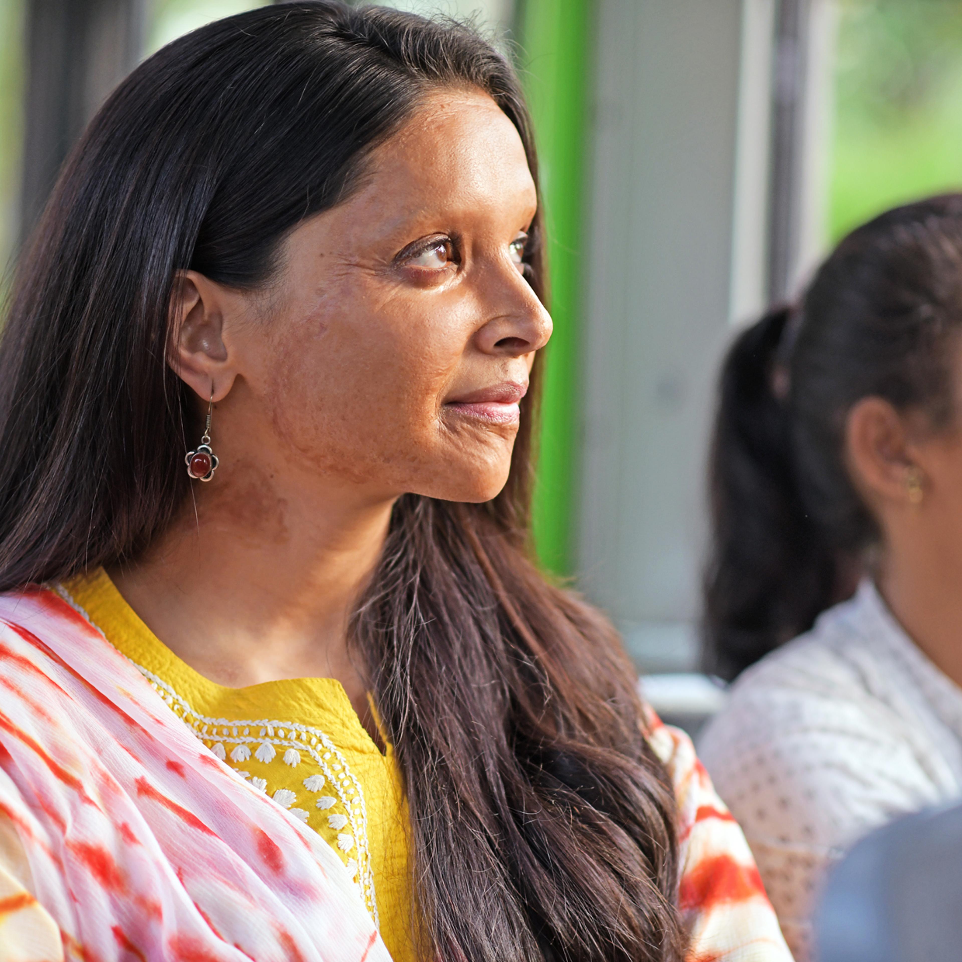 Deepika Padukone stars in new film Chhapaak