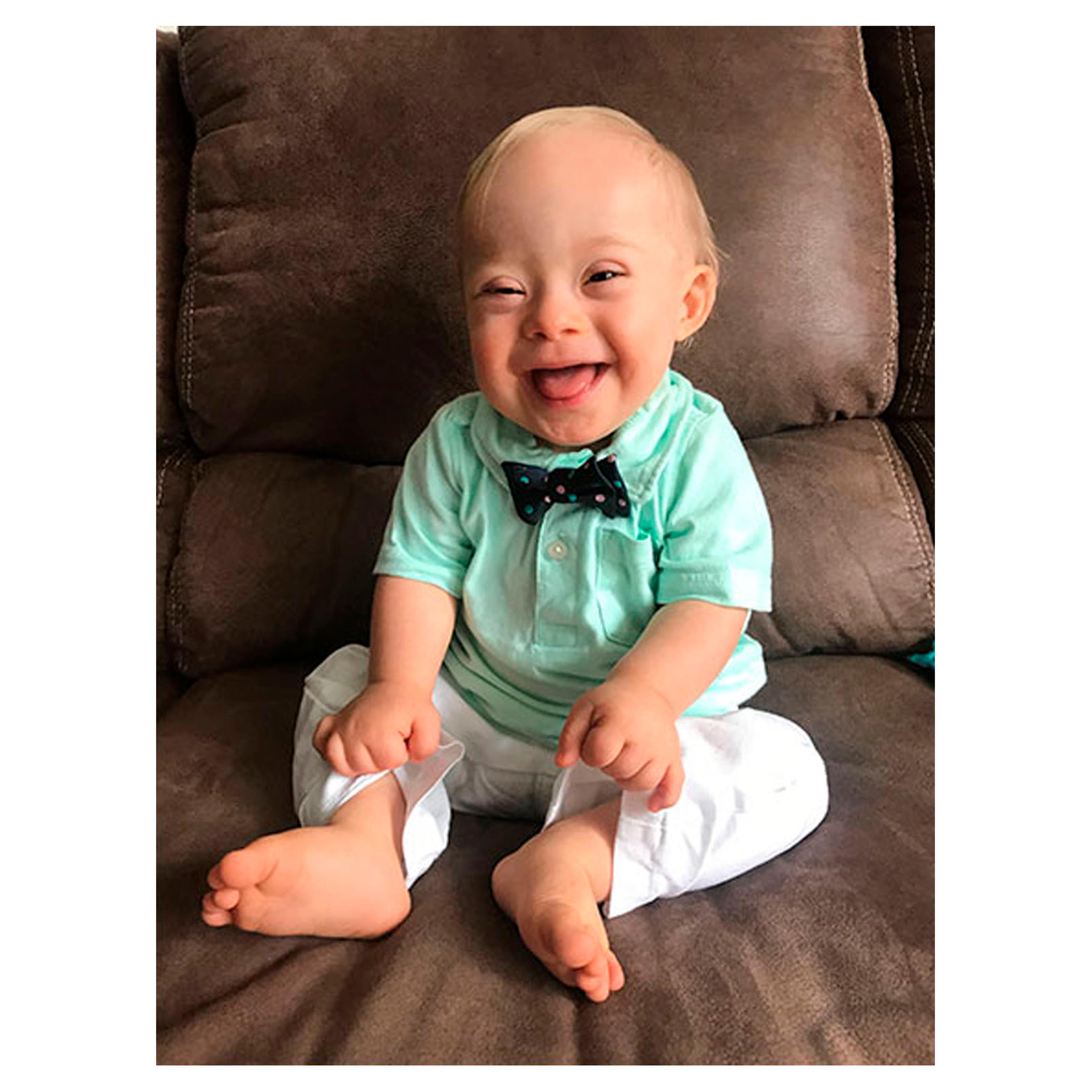 Gerber baby Down Syndrome Lucas