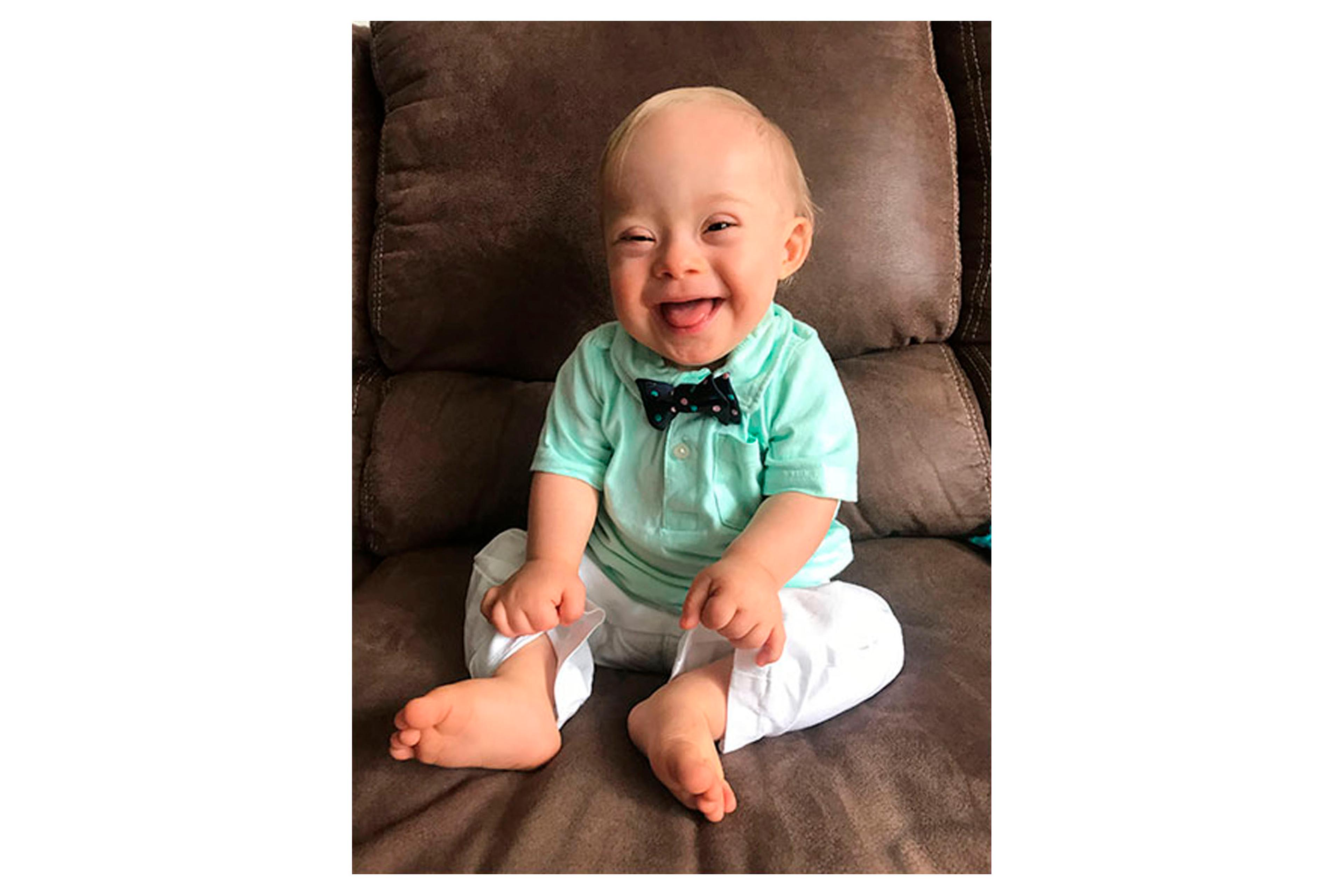 Gerber baby Down Syndrome Lucas