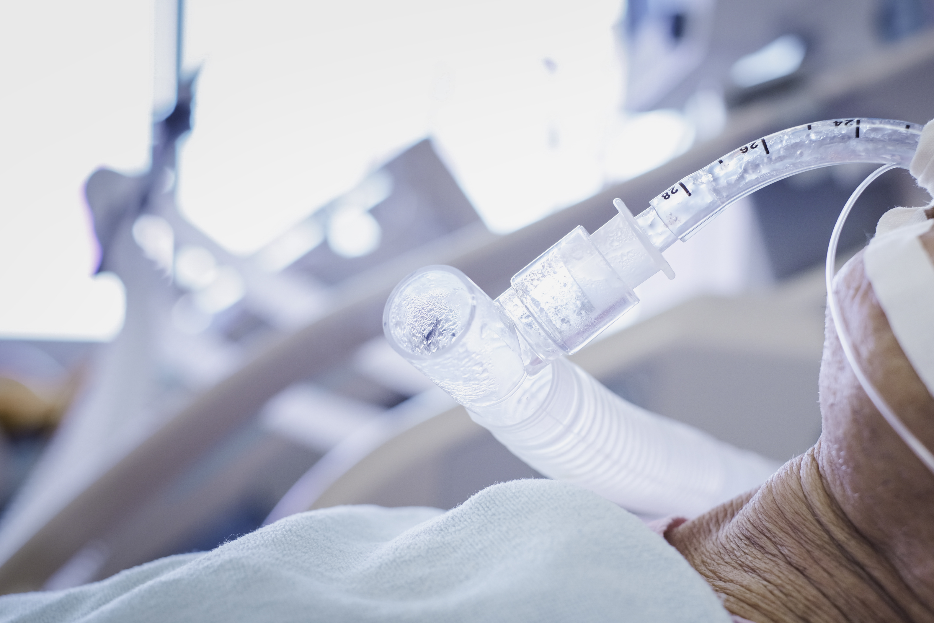 mechanical ventilator