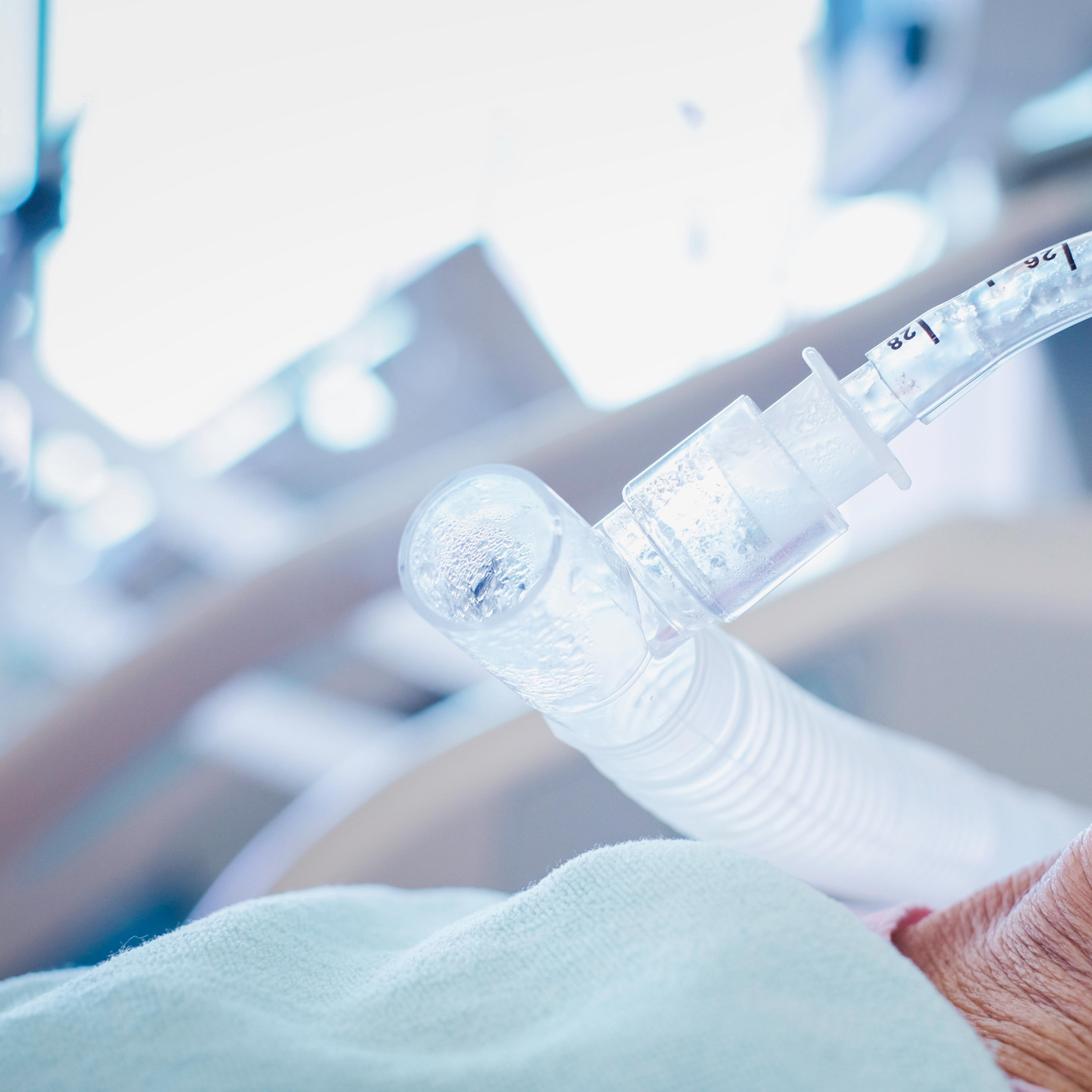 mechanical ventilator