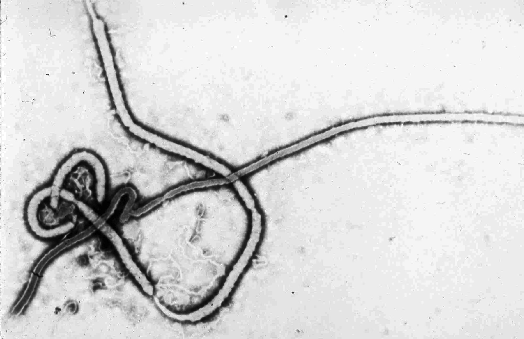 Ebola Virus