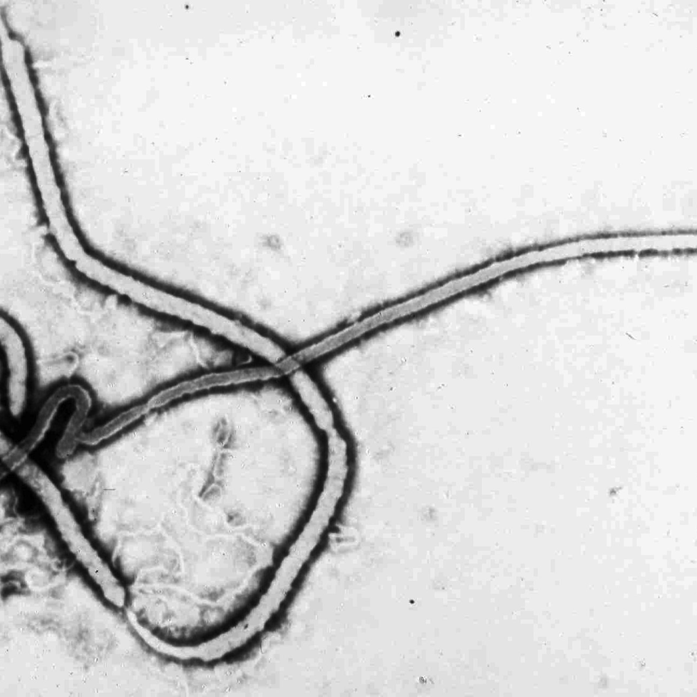 Ebola Virus