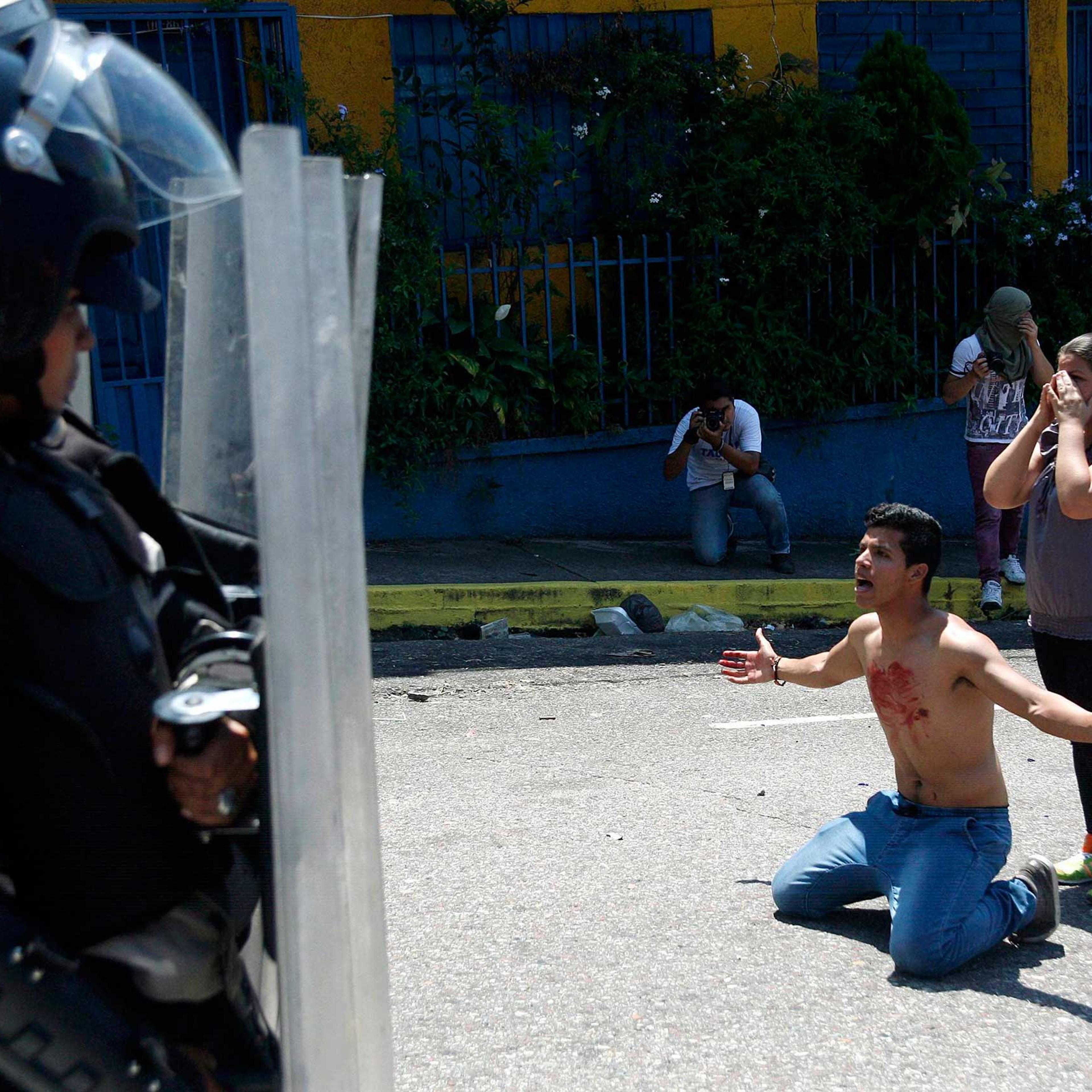 A boy with blood on his chest kneels in front of police after 14-year-old student Kluiver Roa died during a protest in San Cristobal, Venezuela, Feb. 24, 2015.