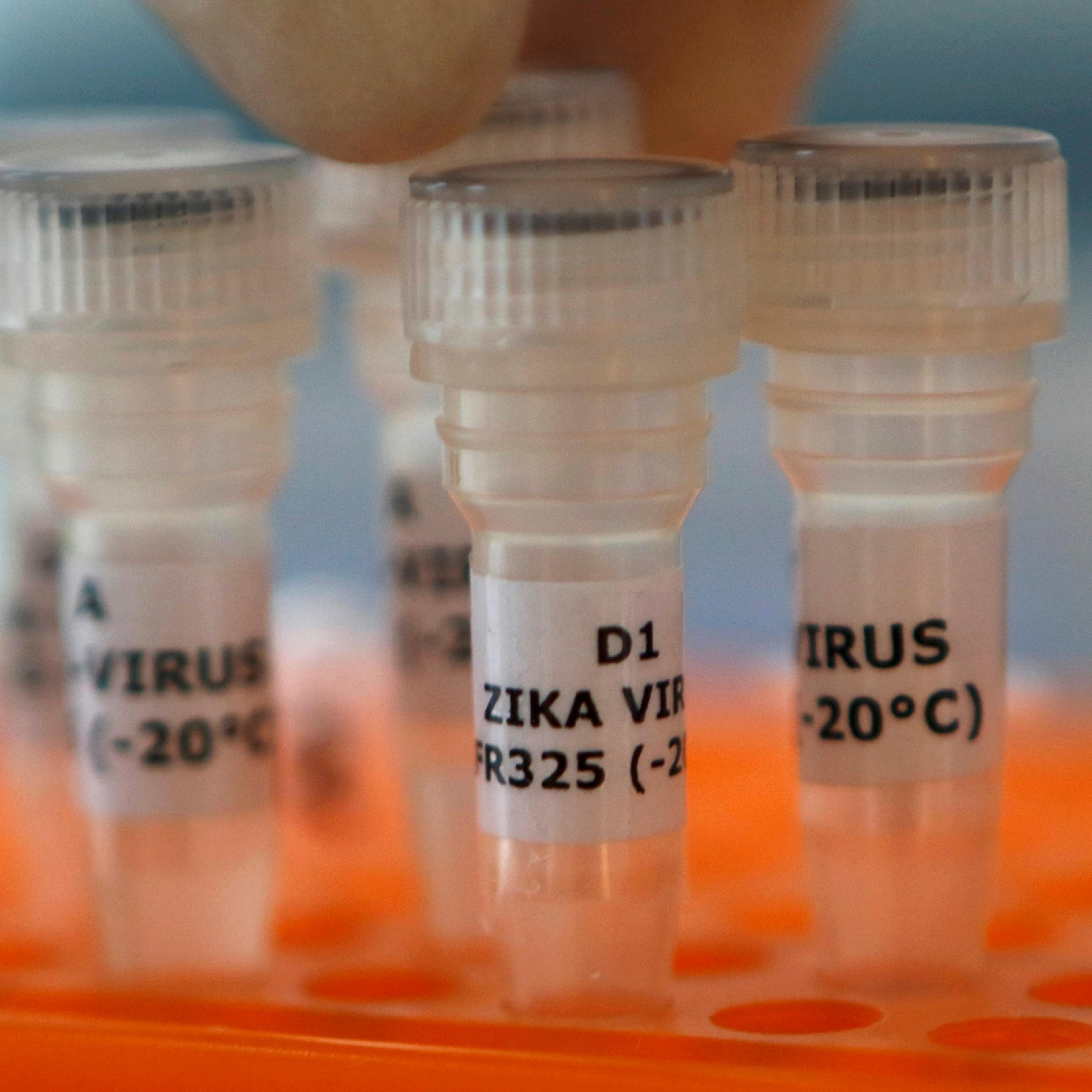 An employee examines tubes with the label 'Zika virus' at Genekam Biotechnology AG in Duisburg