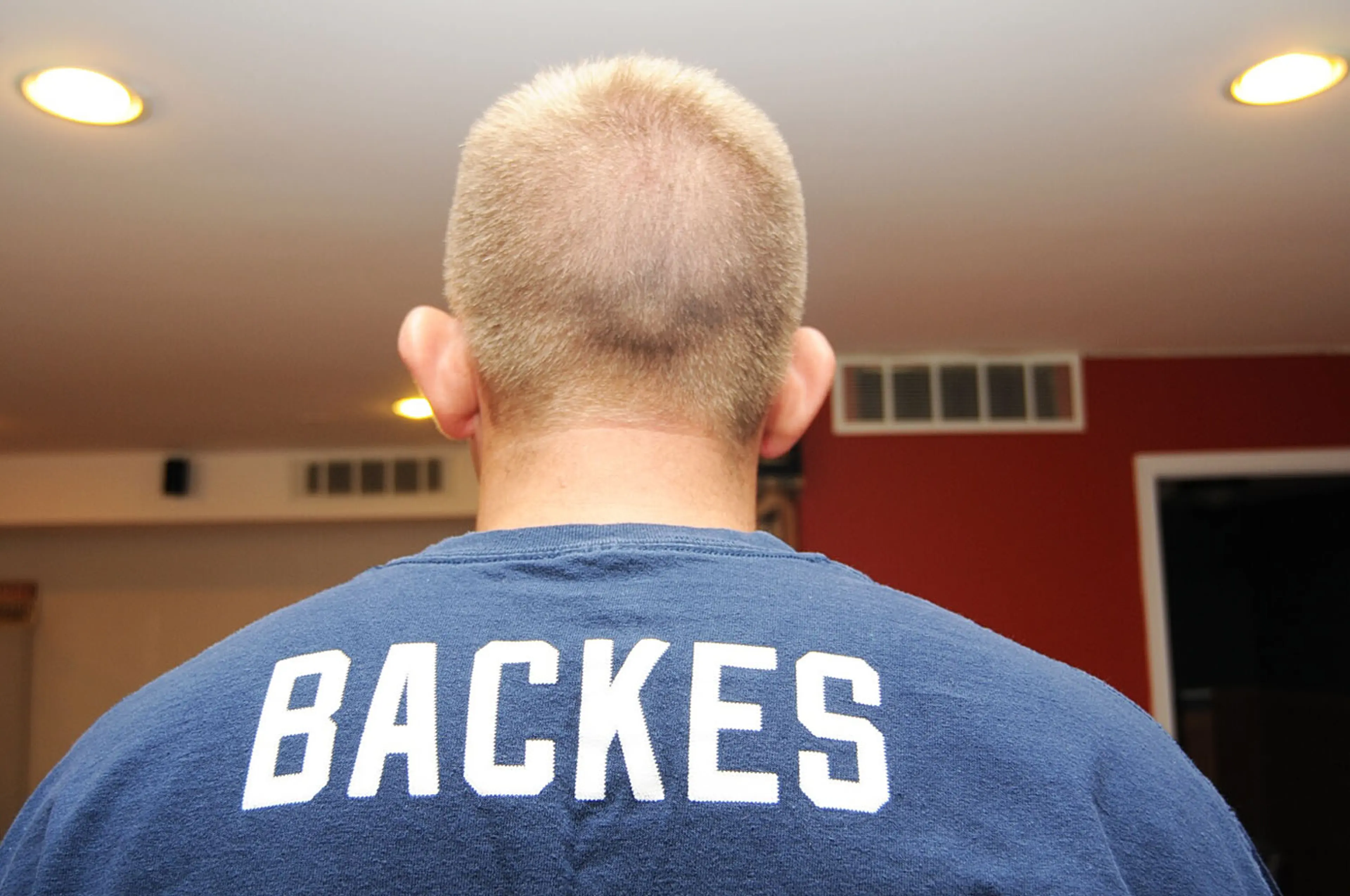 An undated evidence photograph made available by the St. Louis County prosecutors office on Nov. 25, 2014 shows Ferguson police officer Darren Wilson after the shooting of Michael Brown.