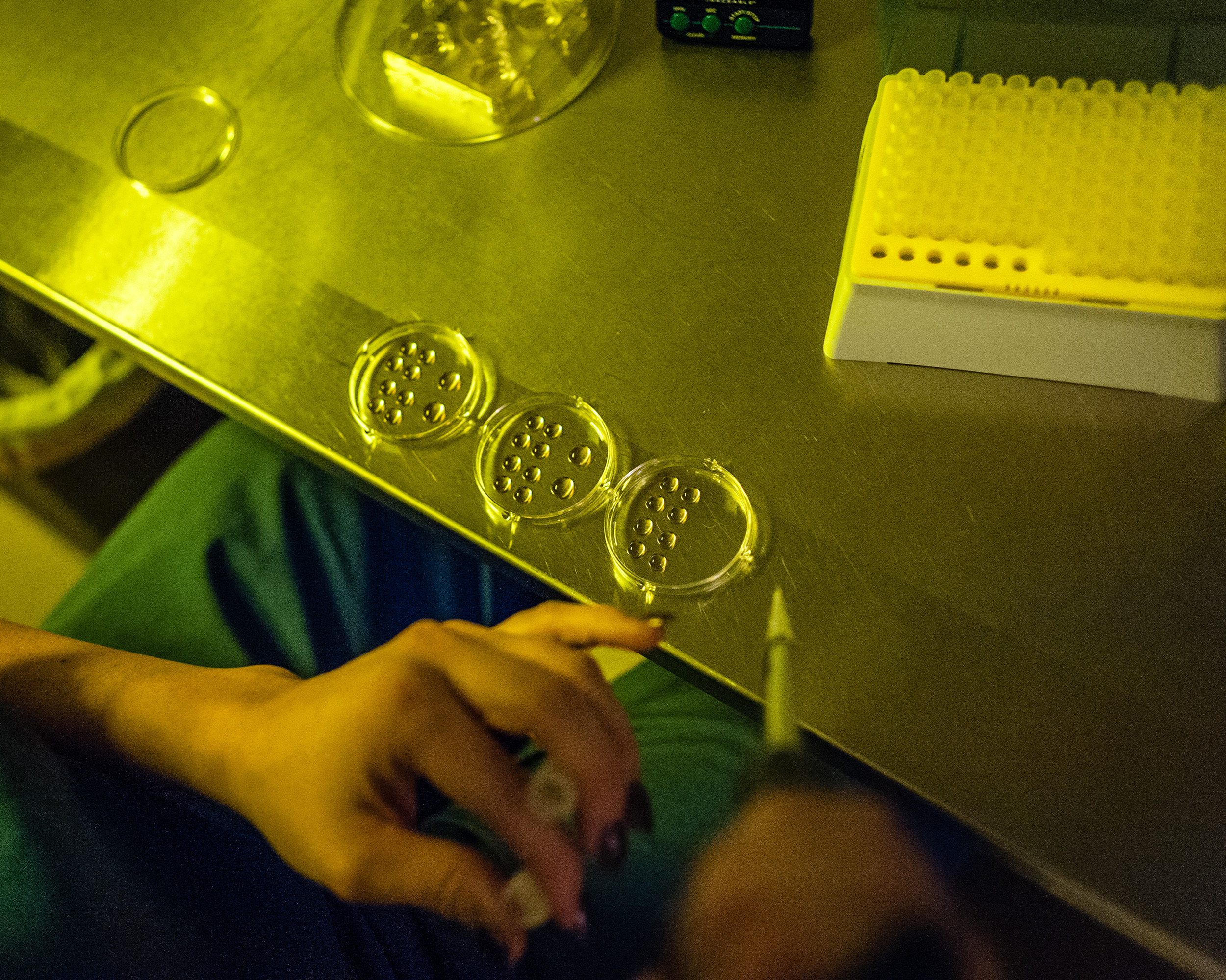 Embryologist, Olga Pilshchikova prepares some eggs for thawing at Shady Grove Fertility in Rockville, MD on Nov. 11, 2014.