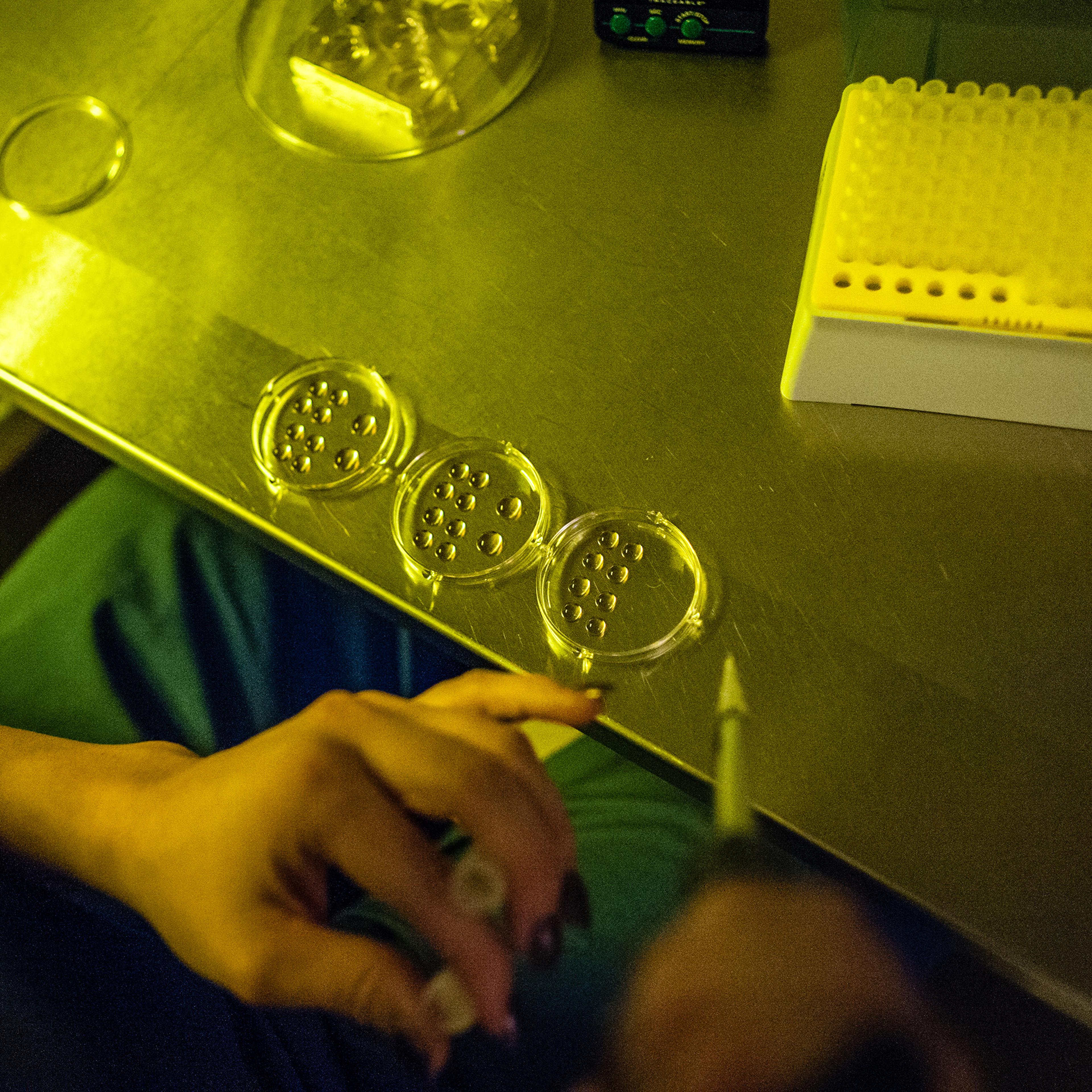 Embryologist, Olga Pilshchikova prepares some eggs for thawing at Shady Grove Fertility in Rockville, MD on Nov. 11, 2014.
