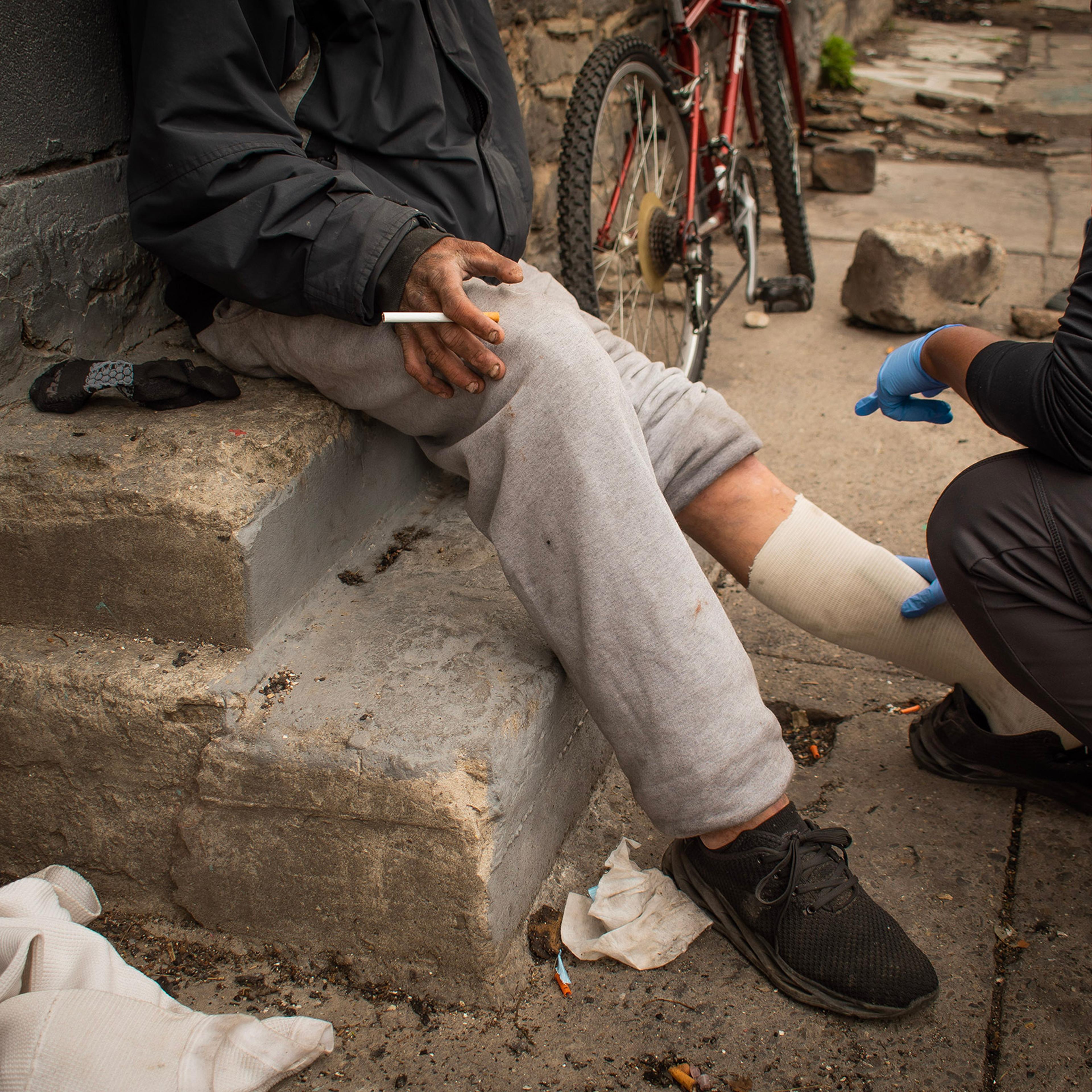 Lydia Williams, a certified wound care nurse, rebinds a patient's wounds during her shift offering street-side medical services throughout Kensington in Philadelphia, on April 27, 2023.