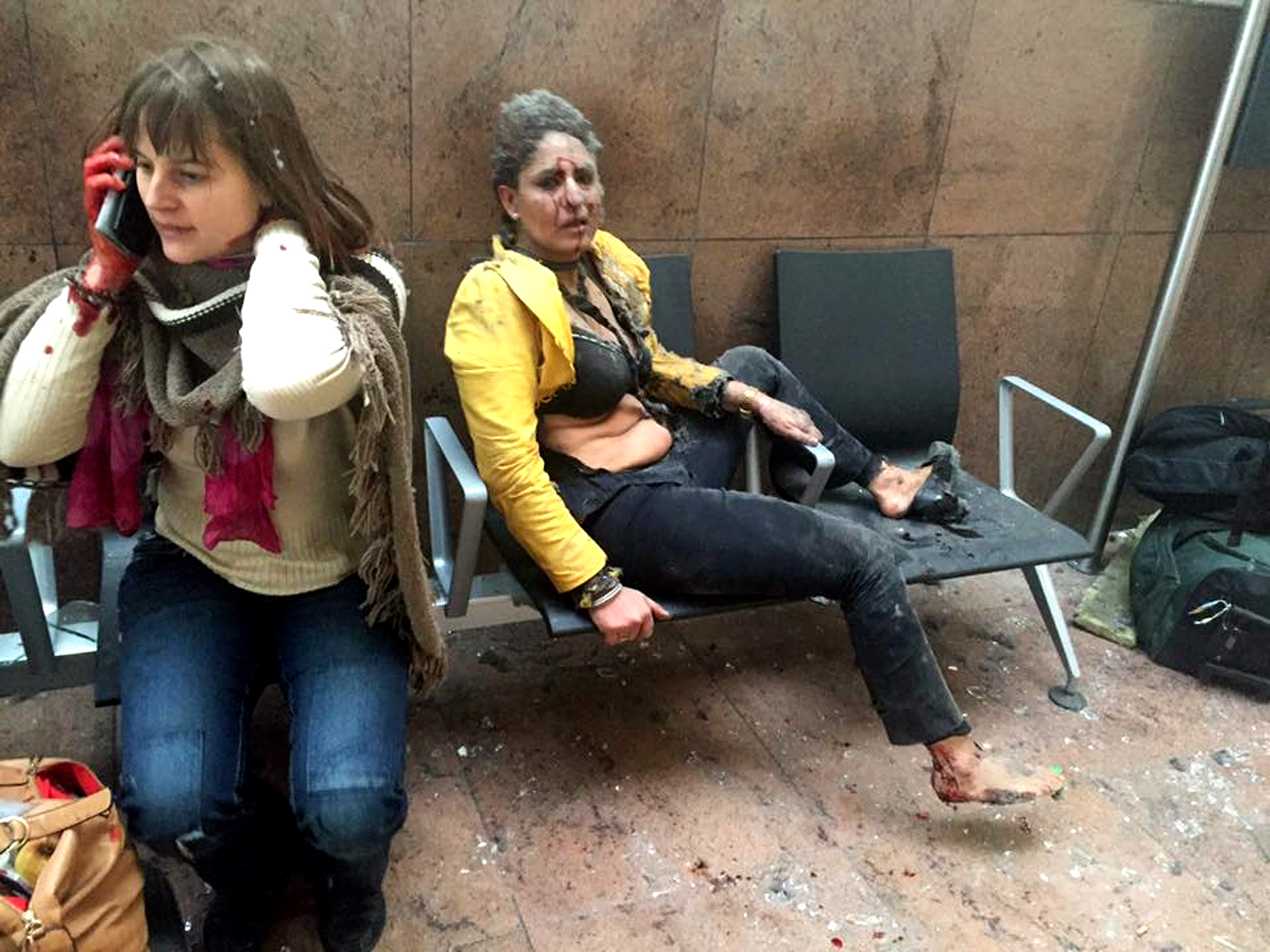 Brussels Attack: The Story Behind the Iconic Victim Photo