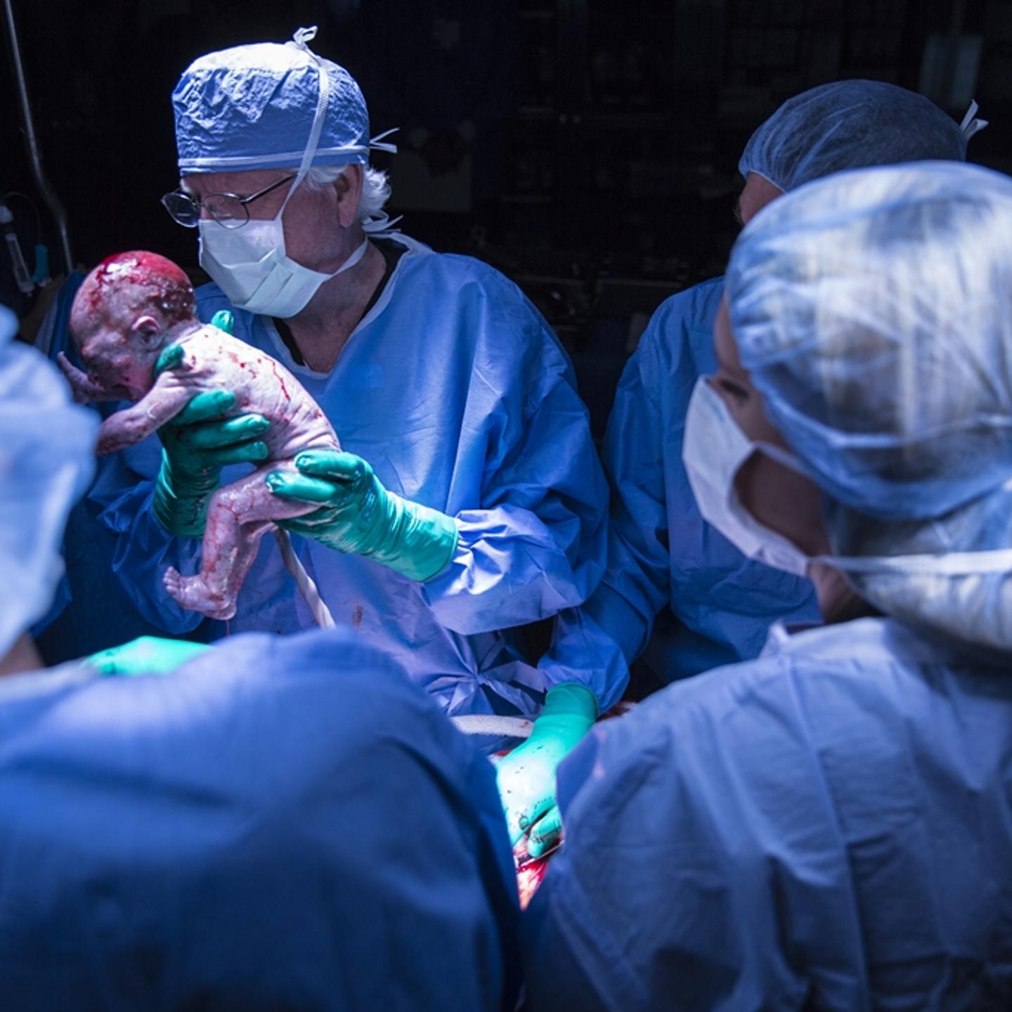 Dr. Robert T. Gunby Jr., holds up the baby for the mother to see.