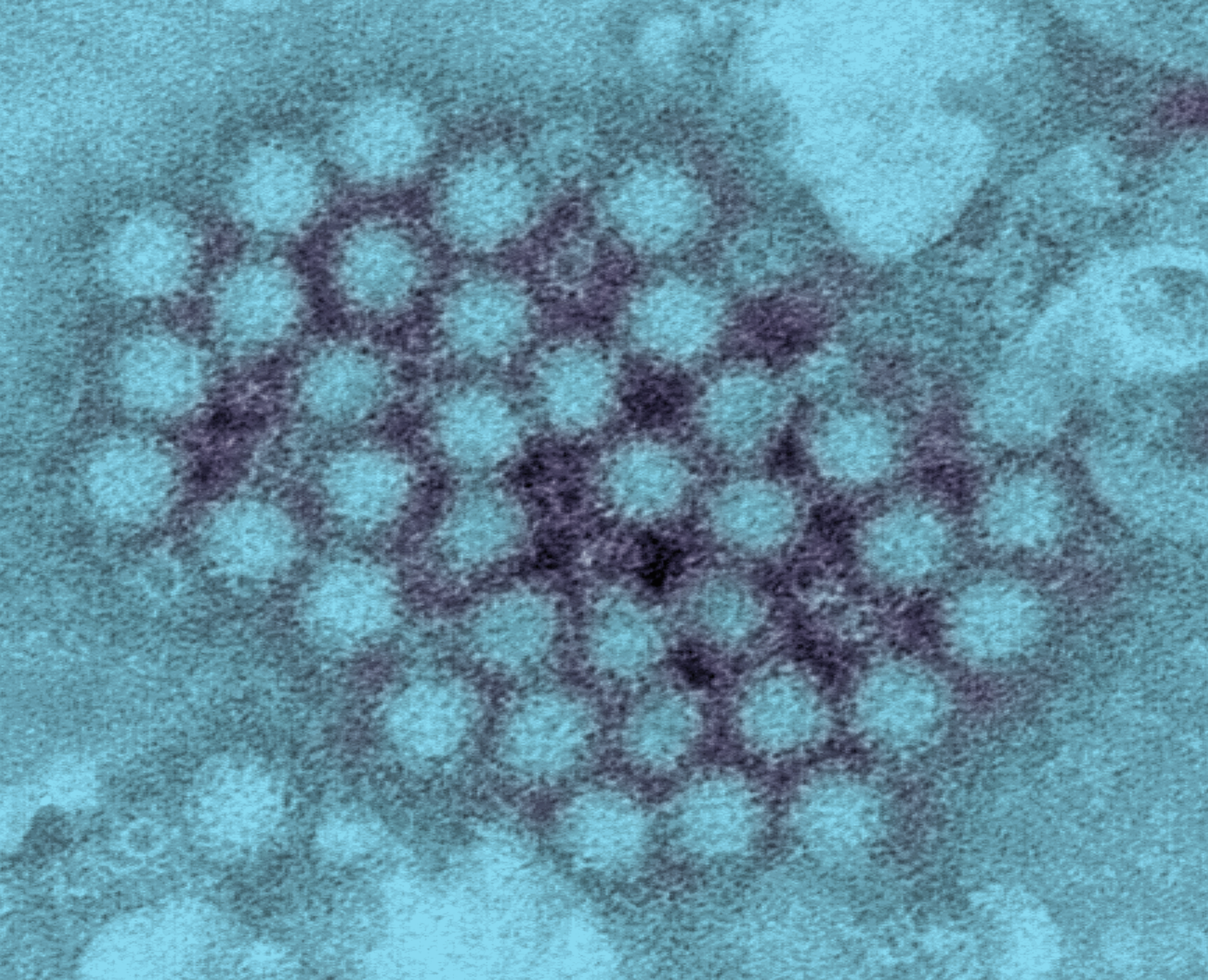 norovirus