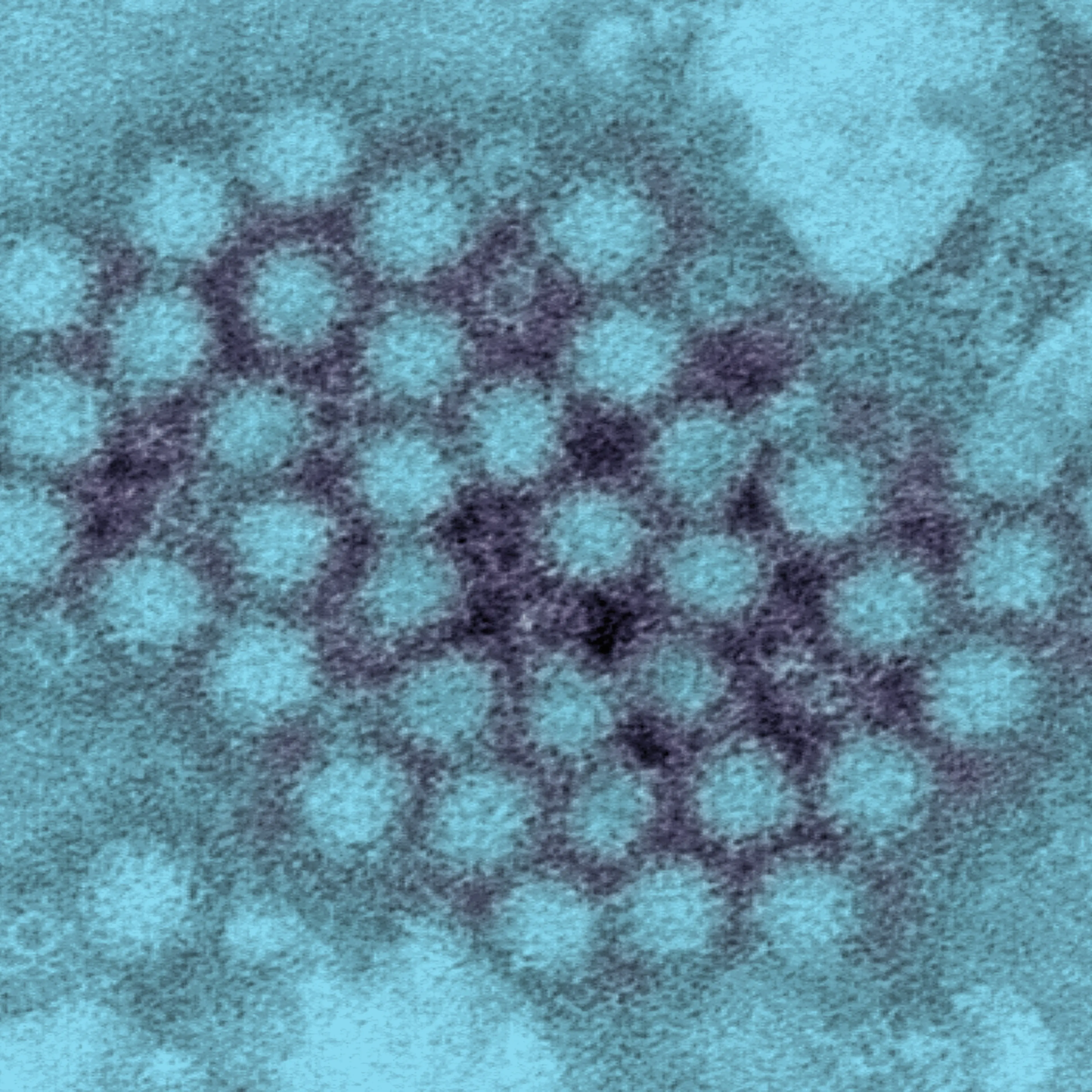norovirus