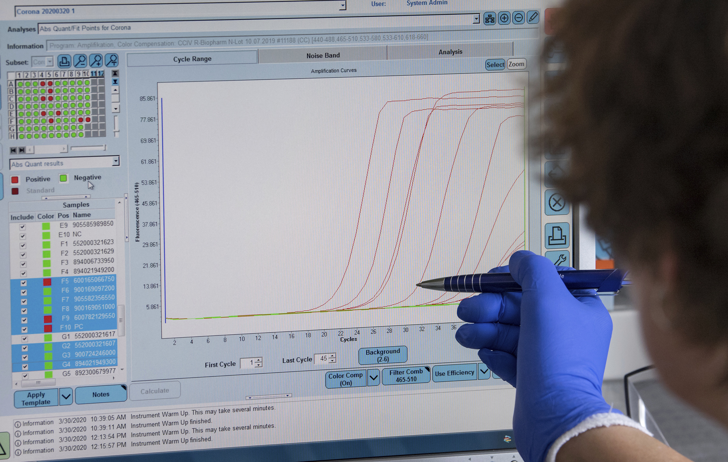 A medical-technical assistant shows the graphic evaluation of negative and positive corona tests on a monitor