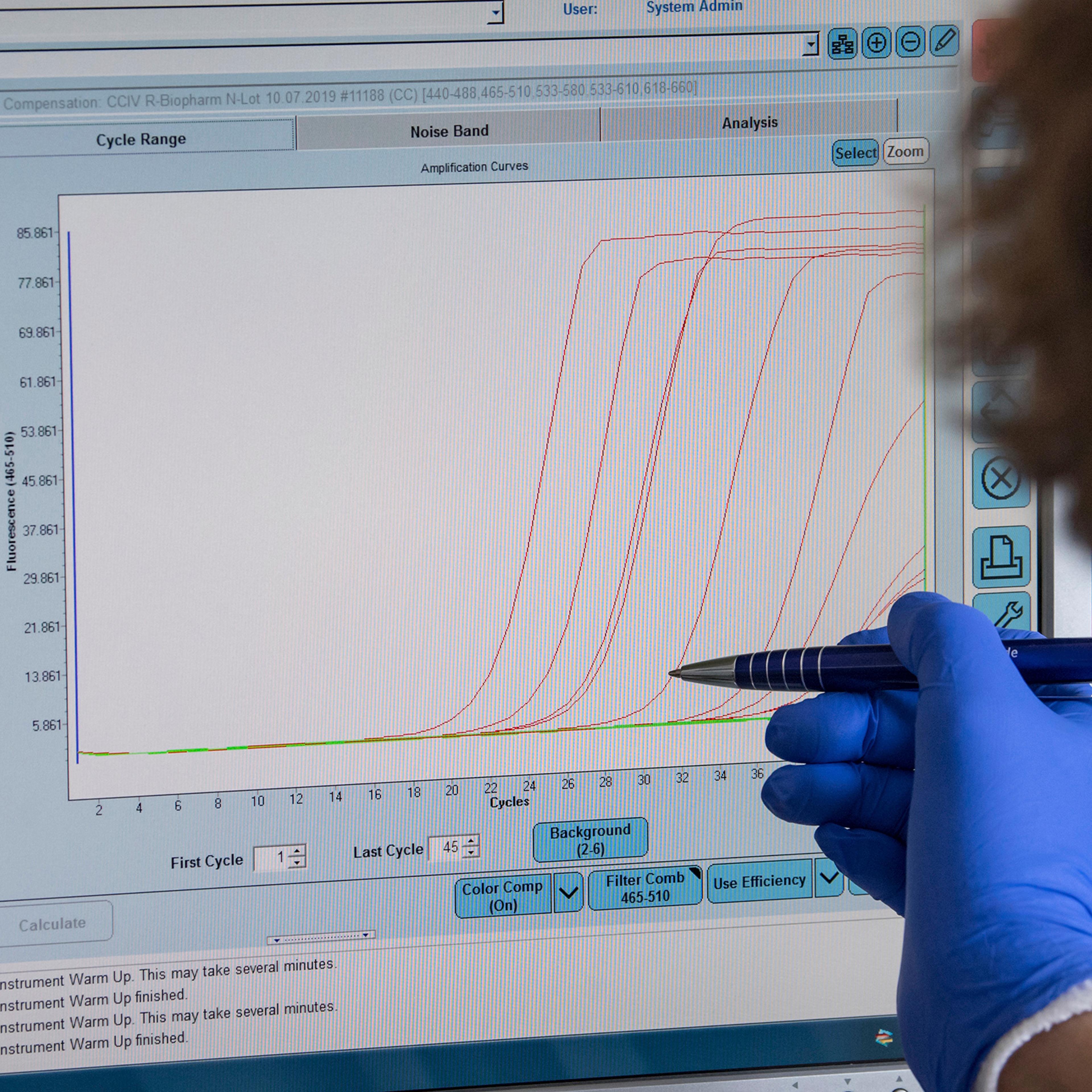 A medical-technical assistant shows the graphic evaluation of negative and positive corona tests on a monitor