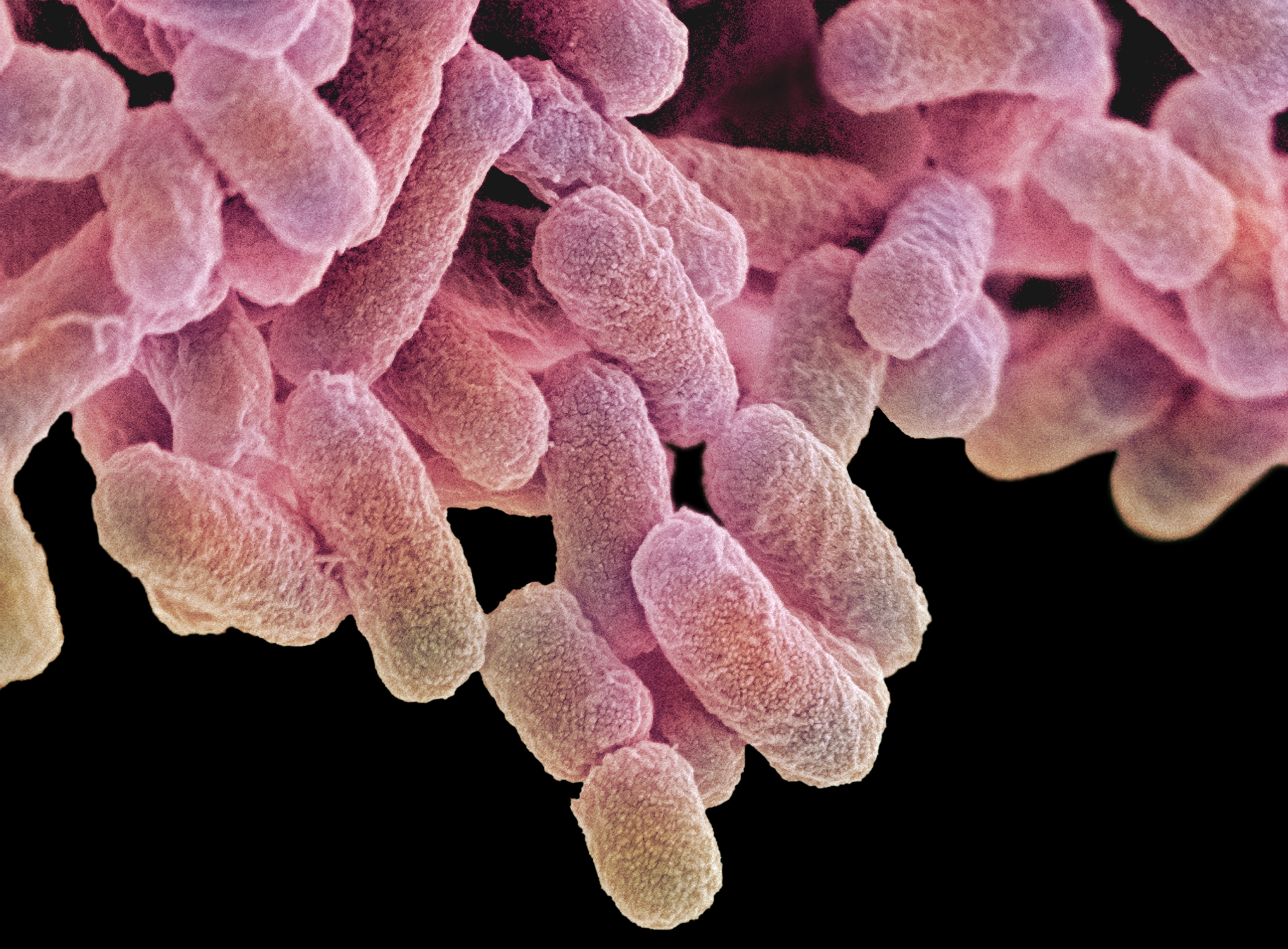 Colored scanning electron micrograph (SEM)