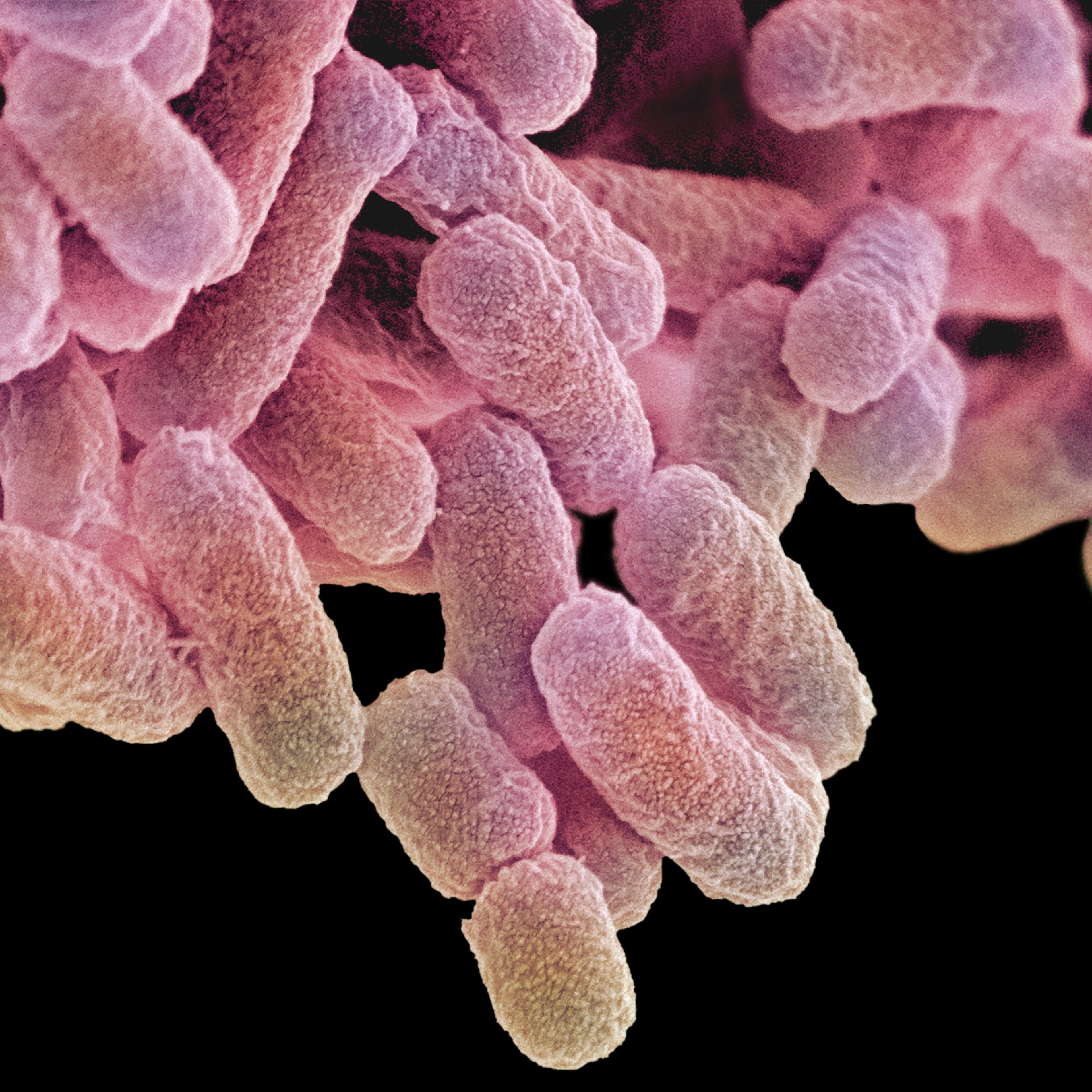 Colored scanning electron micrograph (SEM)