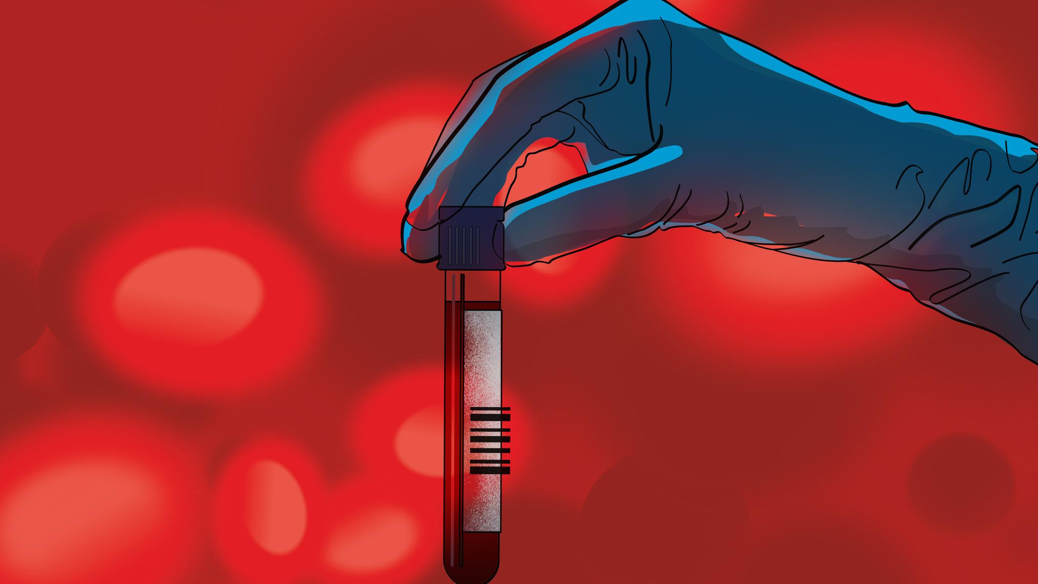 Why the U.S. Urgently Needs More Platelet Donors
