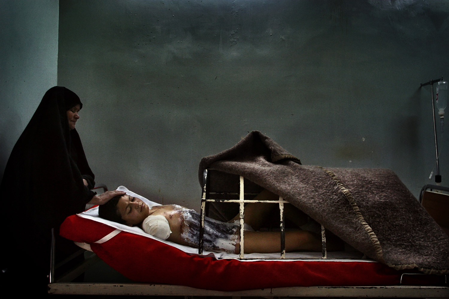 Ali Abbas, 12, is tended to by his distant aunt in Al-Kindy hospital in downtown Baghdad. Abbas doesn't know that the rocket blast which mutilated him, killed his mother, father, brother and 11 other relatives in Jisser Diala neighborhood in the southern the outskirts of Baghdad. 