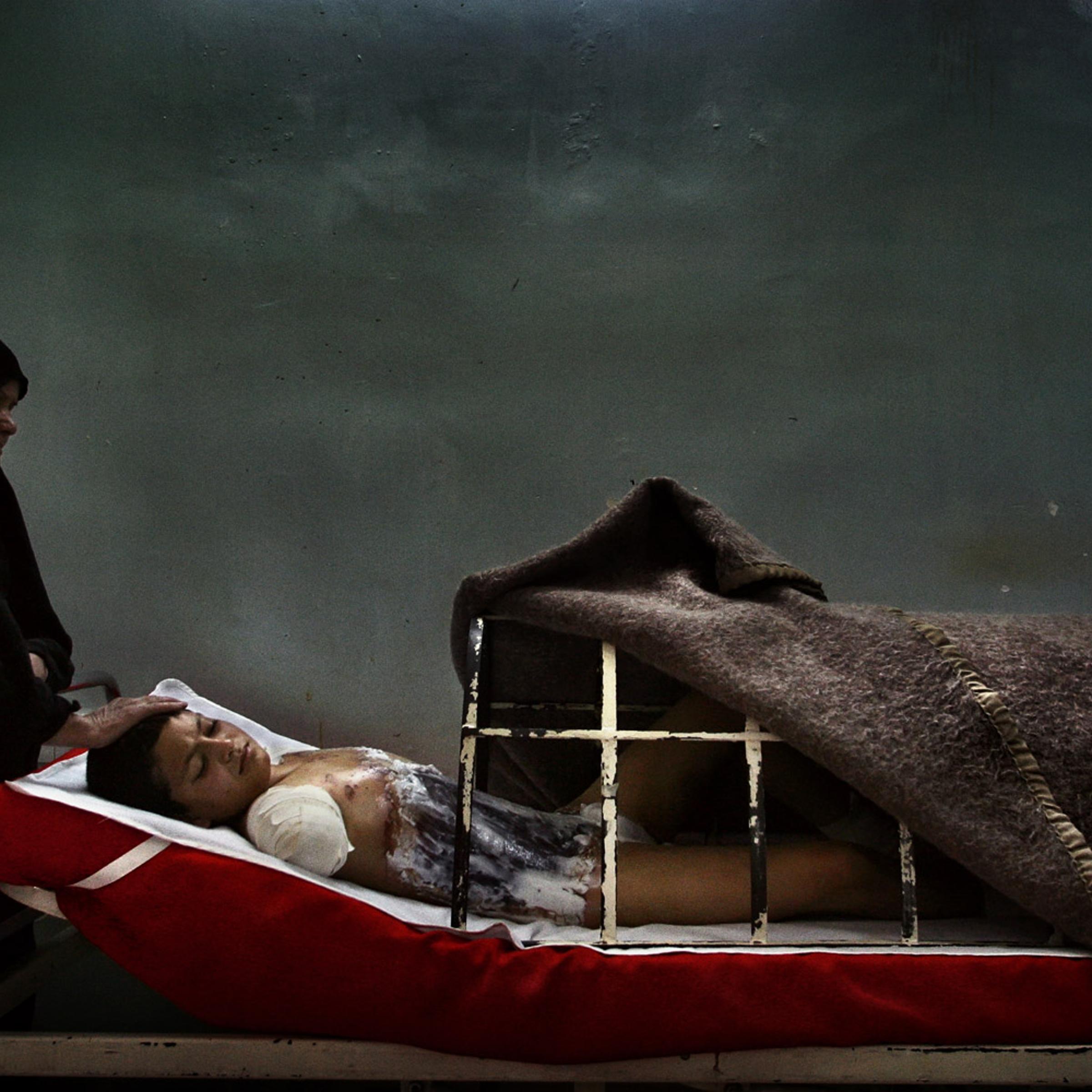 Ali Abbas, 12, is tended to by his distant aunt in Al-Kindy hospital in downtown Baghdad. Abbas doesn't know that the rocket blast which mutilated him, killed his mother, father, brother and 11 other relatives in Jisser Diala neighborhood in the southern the outskirts of Baghdad.