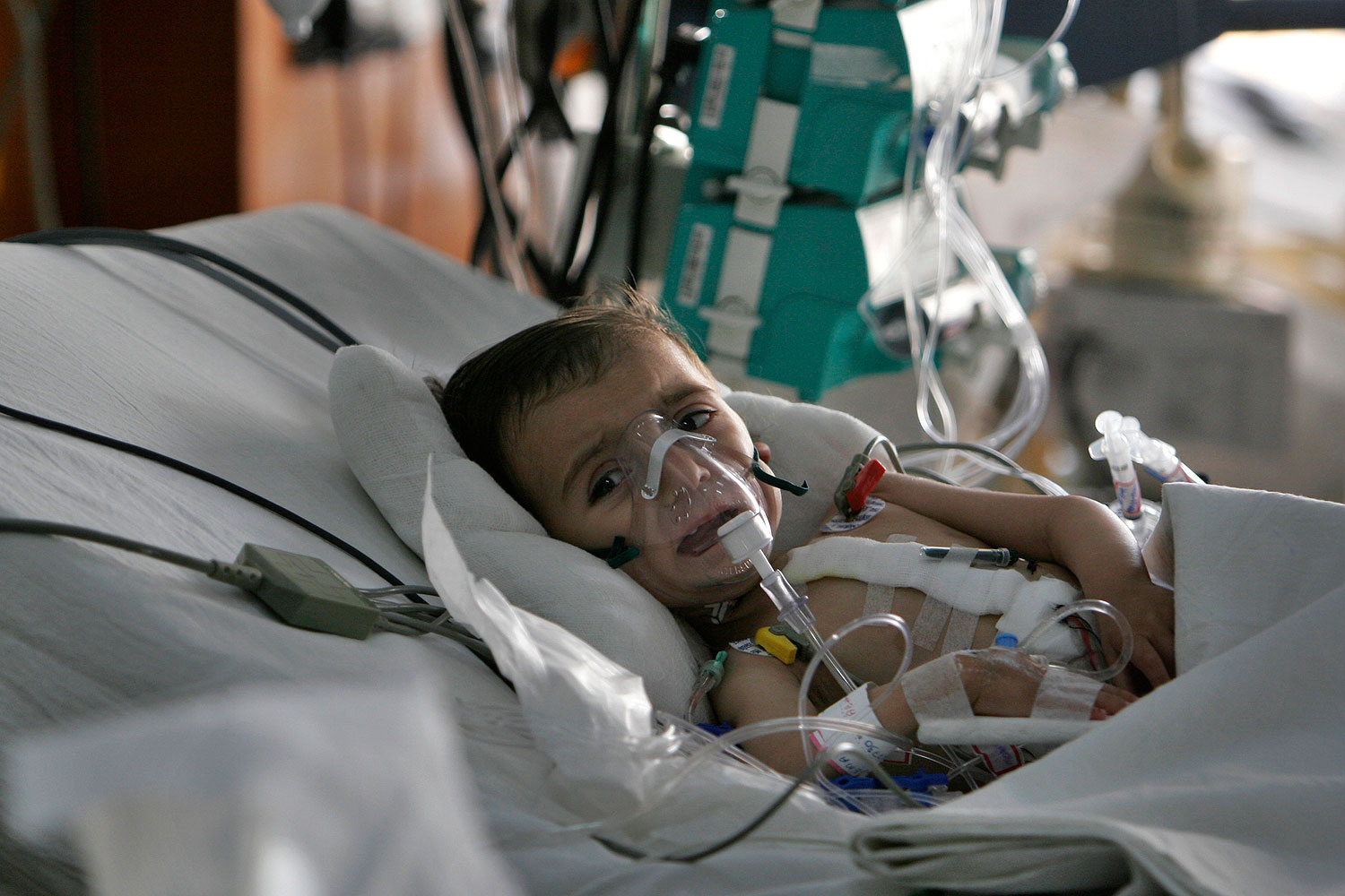 An Afghan child Leema, 17 months, recovers from heart surgery at Narayana Hrudayalaya hospital in Bangalore, India, in this file photo from 2008