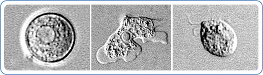Naegleria fowlerii