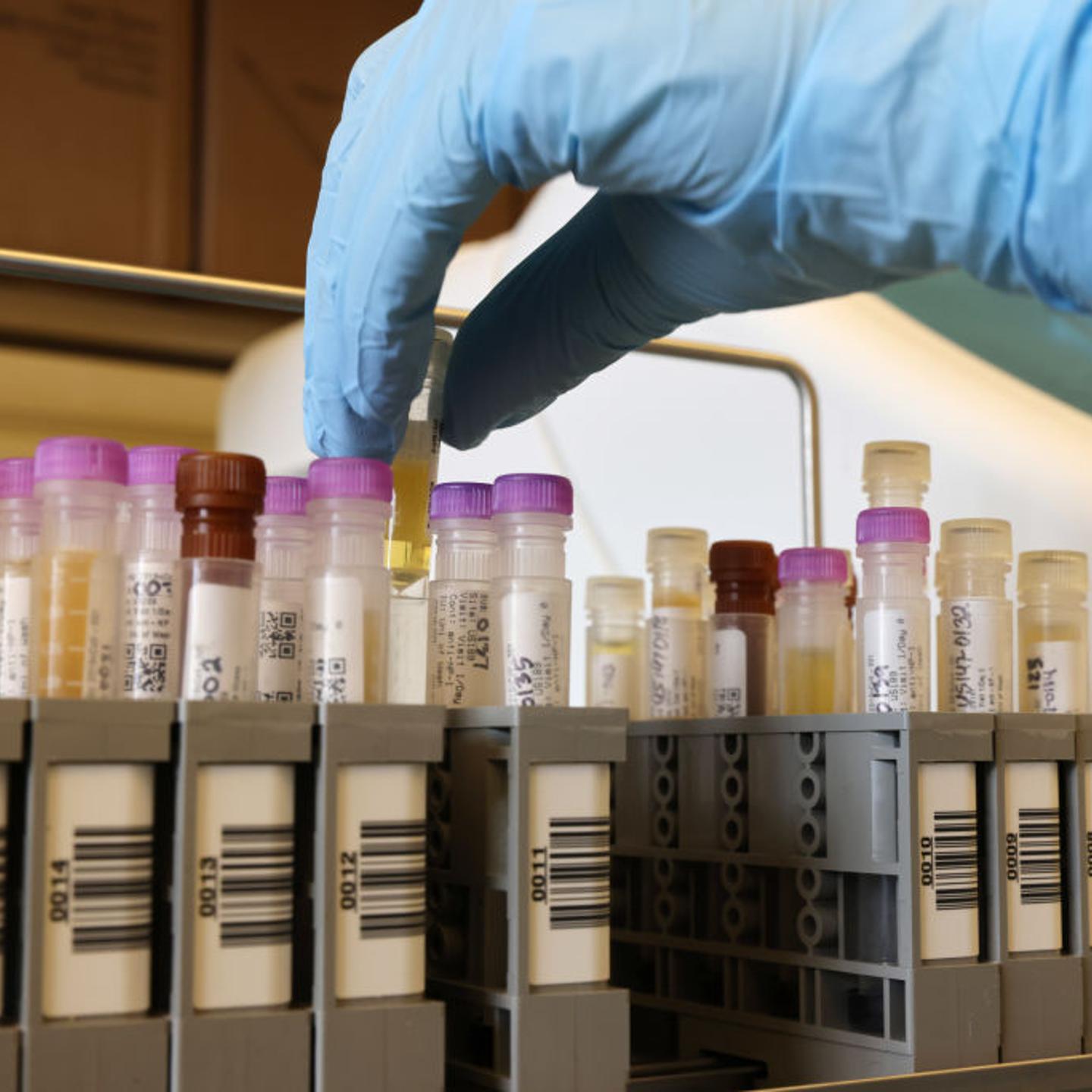 UW Medicine Conducts Novavax COVID-19 Vaccine Clinical Trial