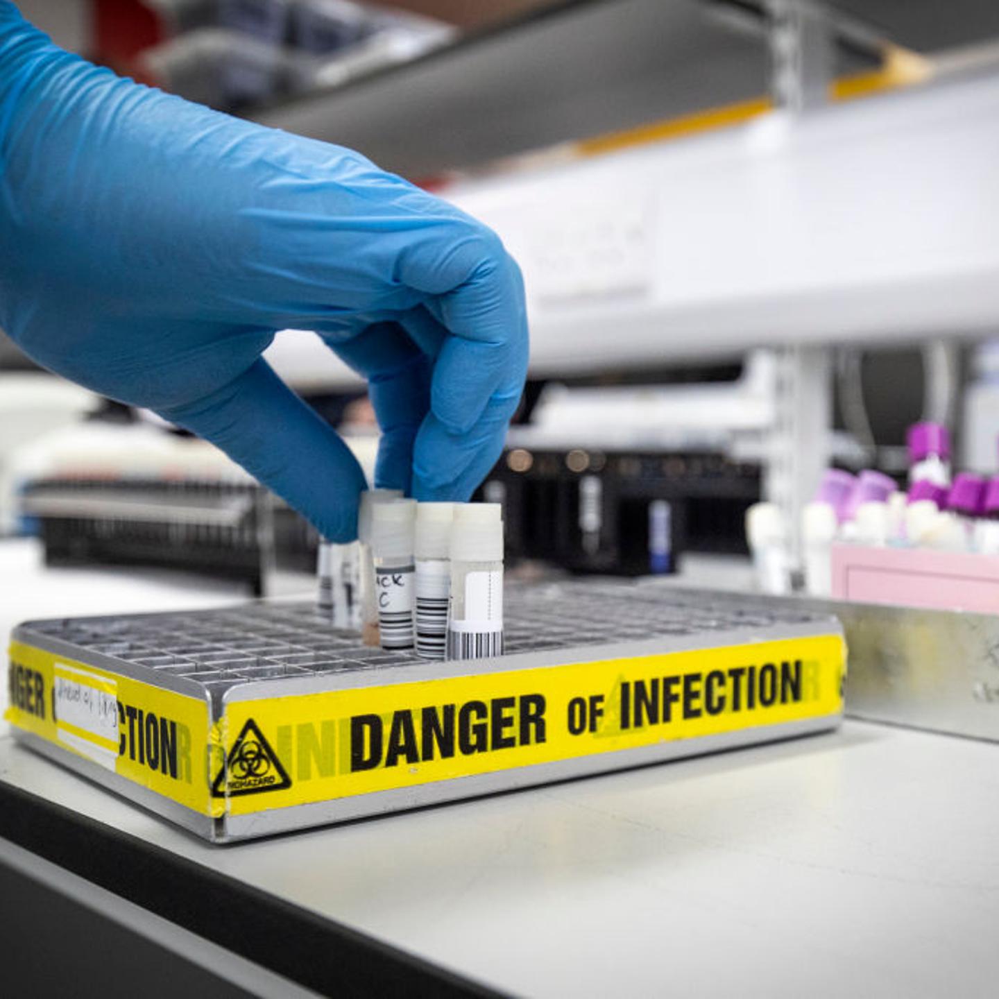 Coronavirus Testing Laboratory In Glasgow
