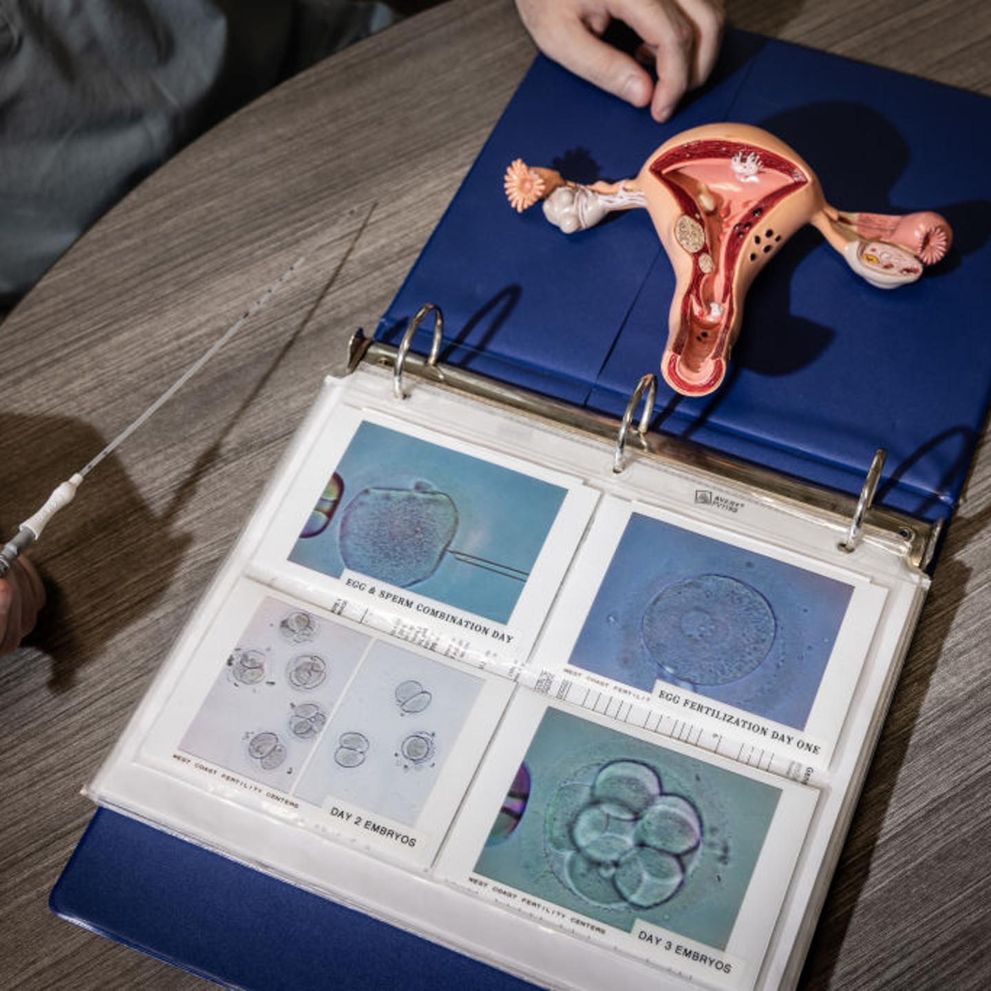 A model of the female reproductive system and an embryo transfer catheter photographed Feb. 29, 2024, in Fountain Valley, CA.