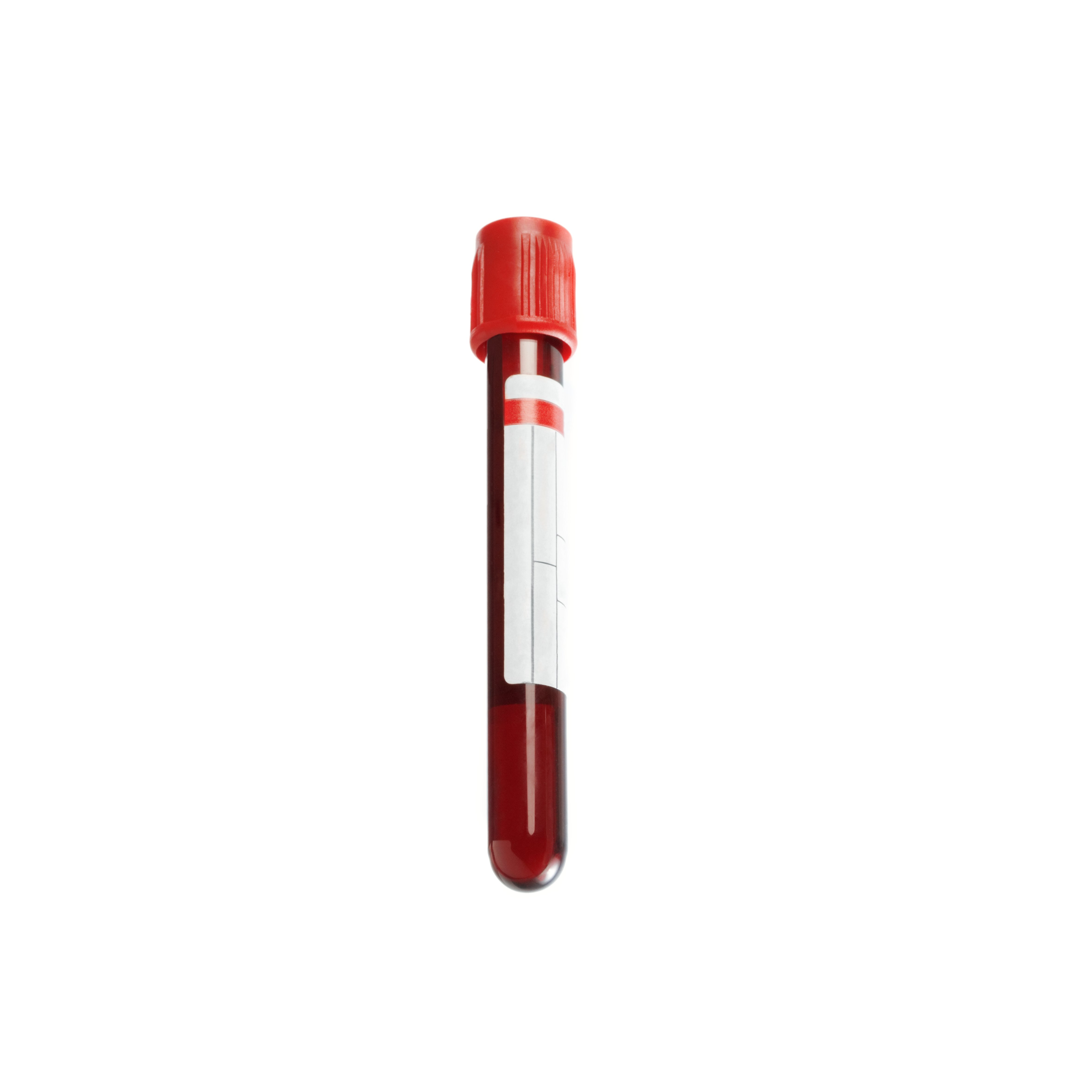 Blood sample