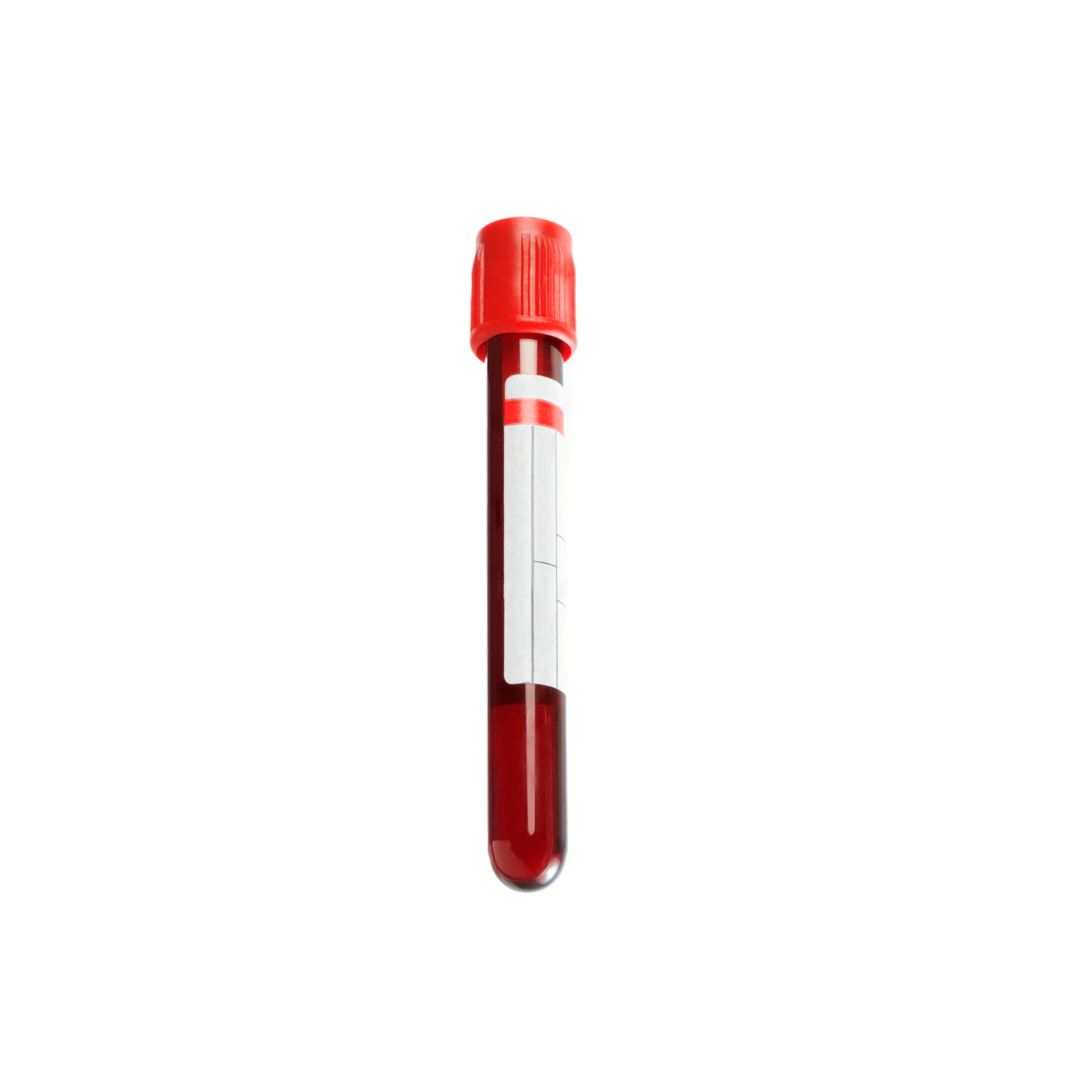 Blood sample