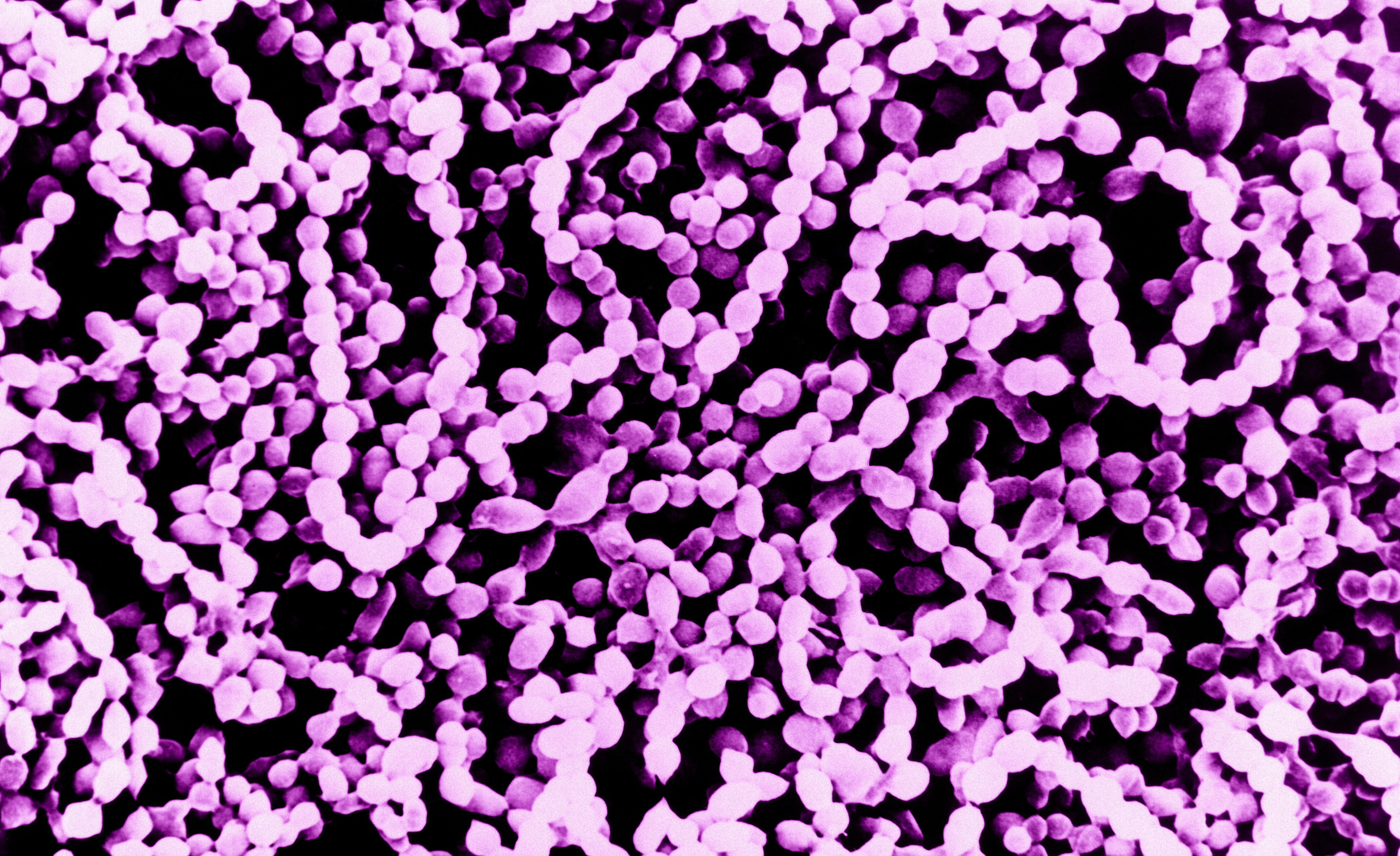 streptococcus-pyogenes