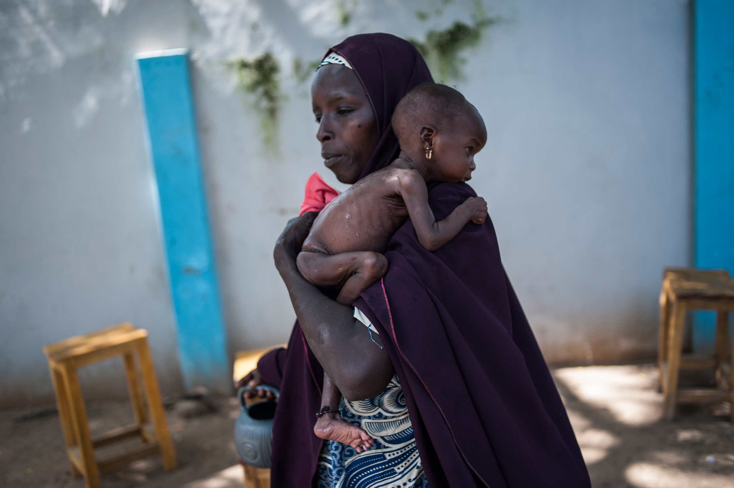 TOPSHOT - This photo taken on September 15, 2016 shows a mother holding her young malnourished baby at a public health facility in the Dalaram district of Maiduguri, northeast Nigeria. Aid agencies have long warned about the risk of food shortages in nor