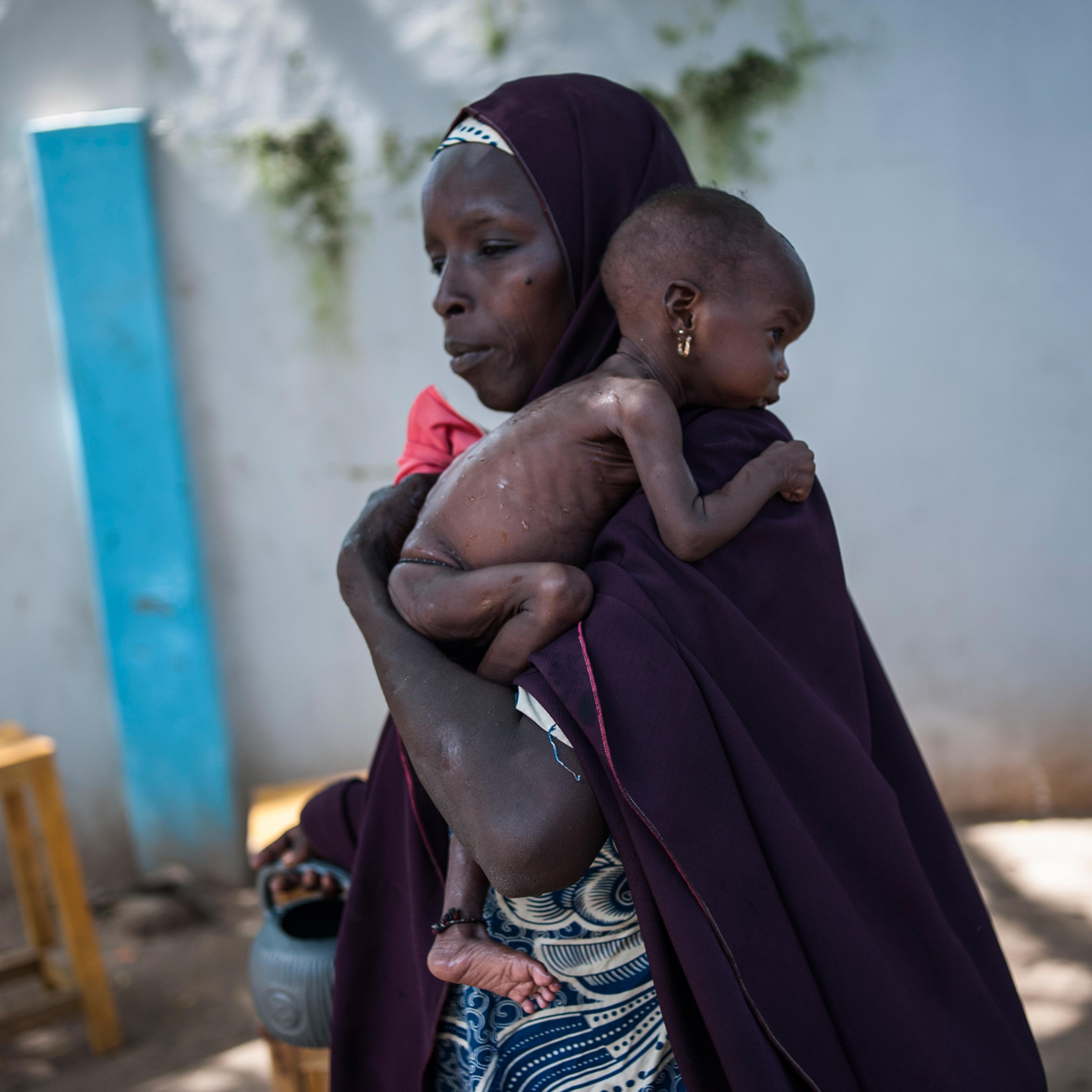 TOPSHOT - This photo taken on September 15, 2016 shows a mother holding her young malnourished baby at a public health facility in the Dalaram district of Maiduguri, northeast Nigeria. Aid agencies have long warned about the risk of food shortages in nor