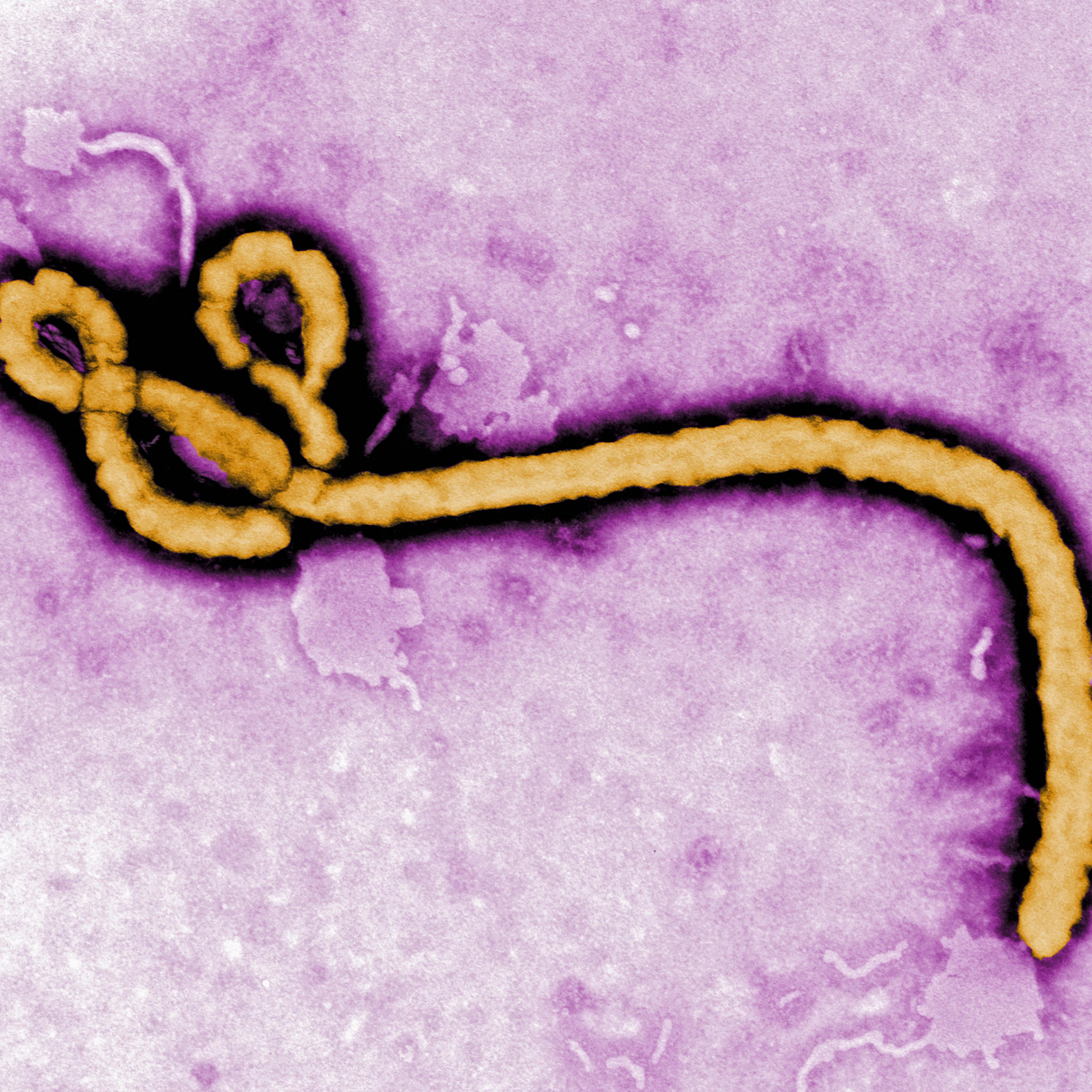 Ebola virus health problems