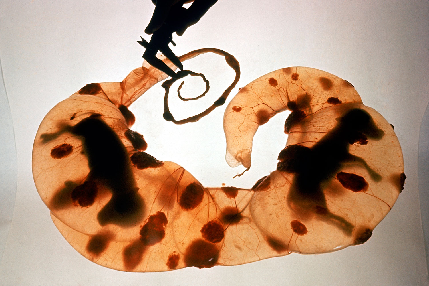 A pair of 90-day-old cow fetuses clearly visible inside an amniotic sac, 1965.