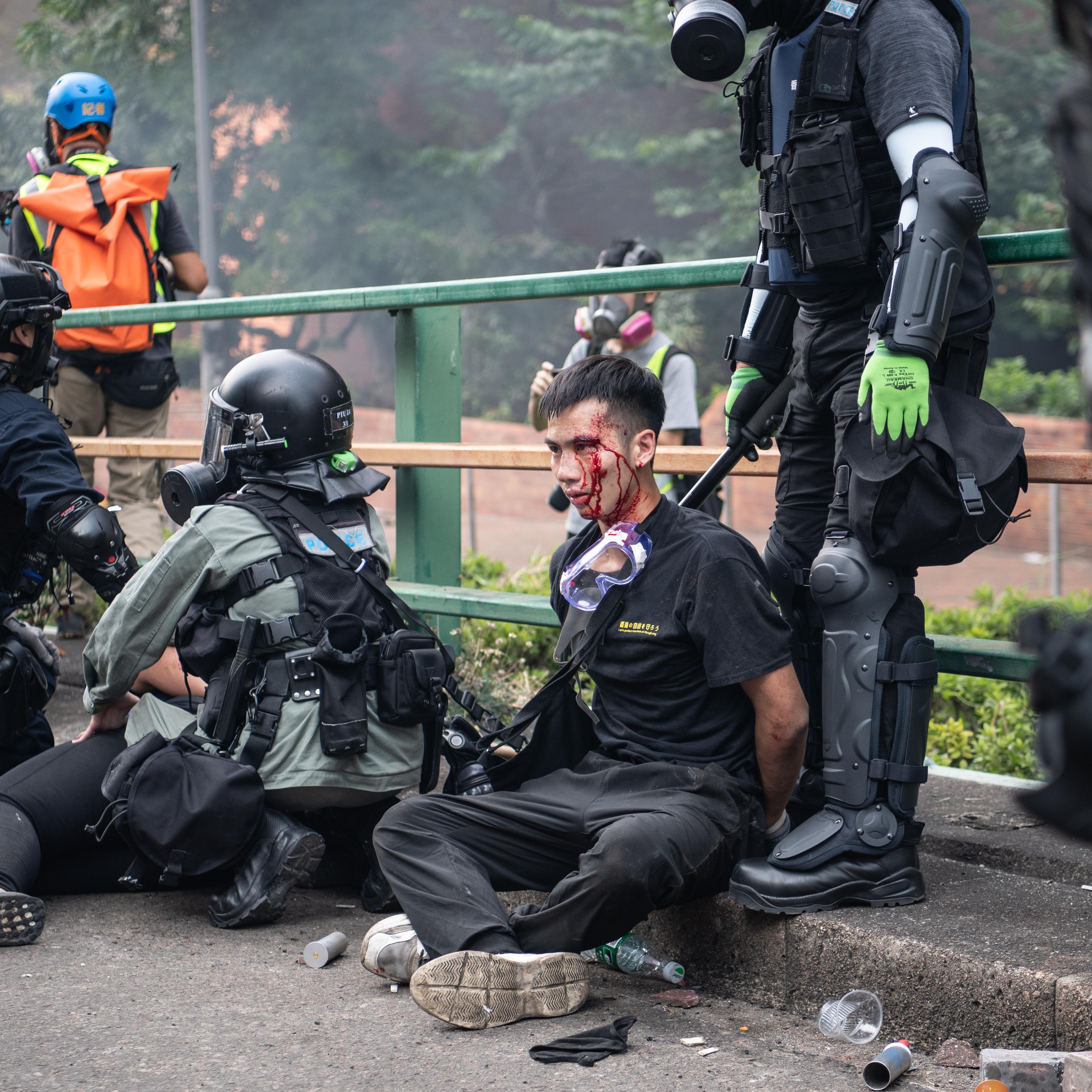 Anti-Government Protests in Hong Kong