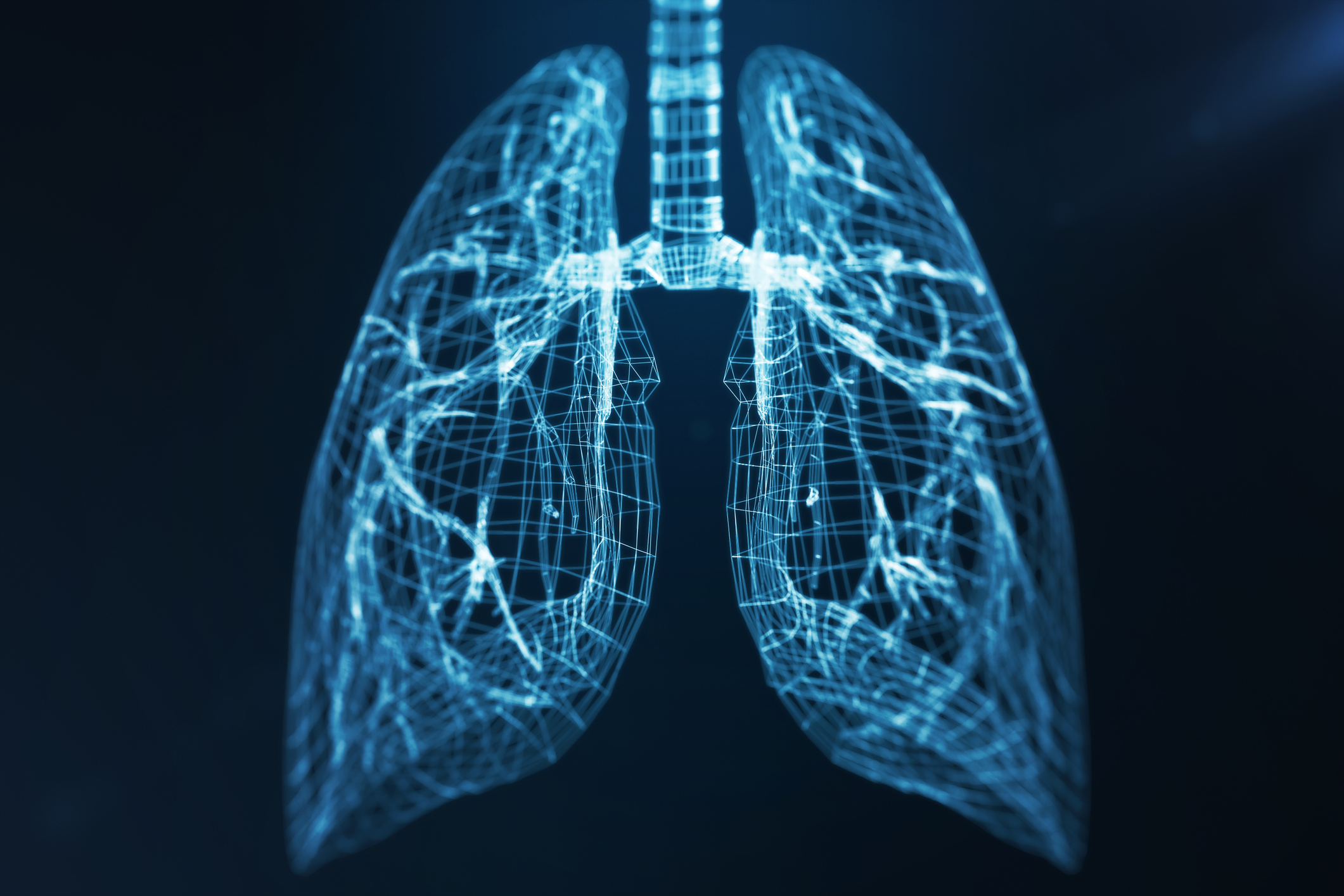 lung-scan
