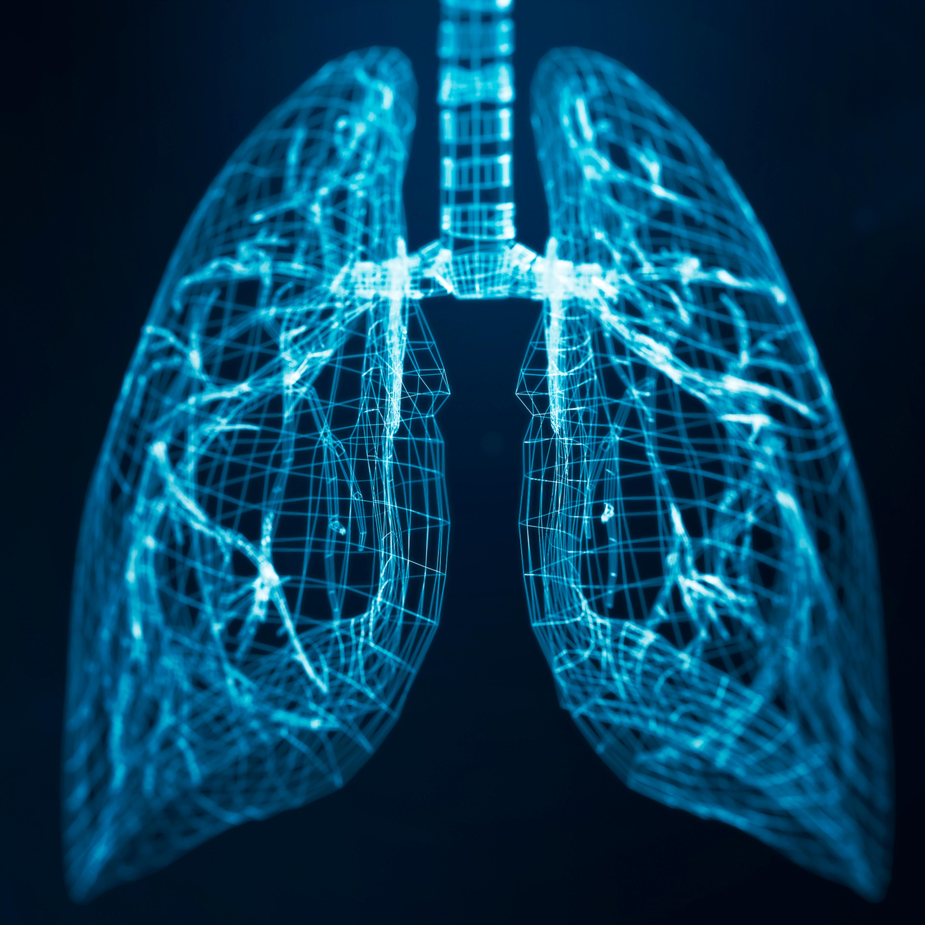 lung-scan