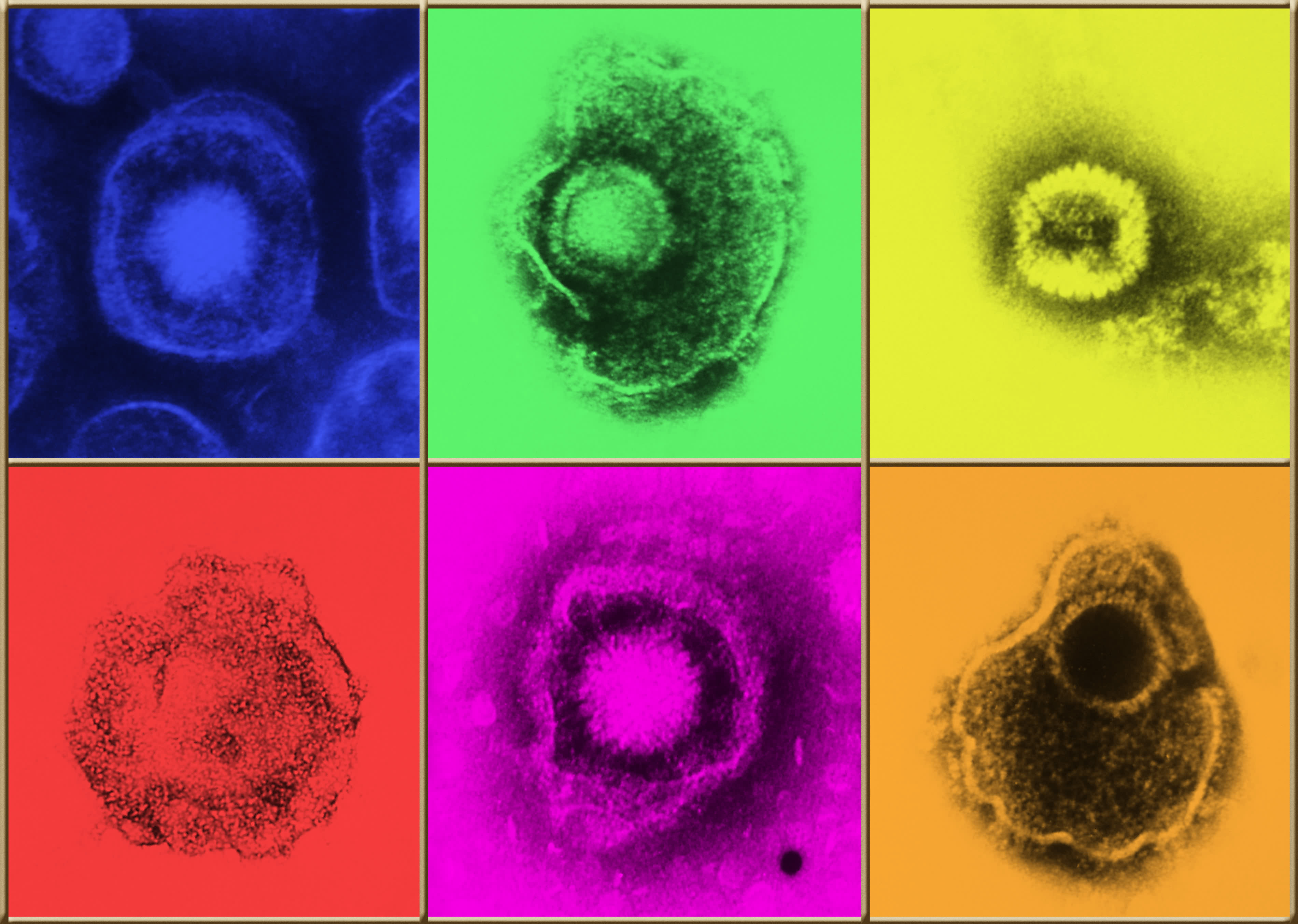Herpes Virus