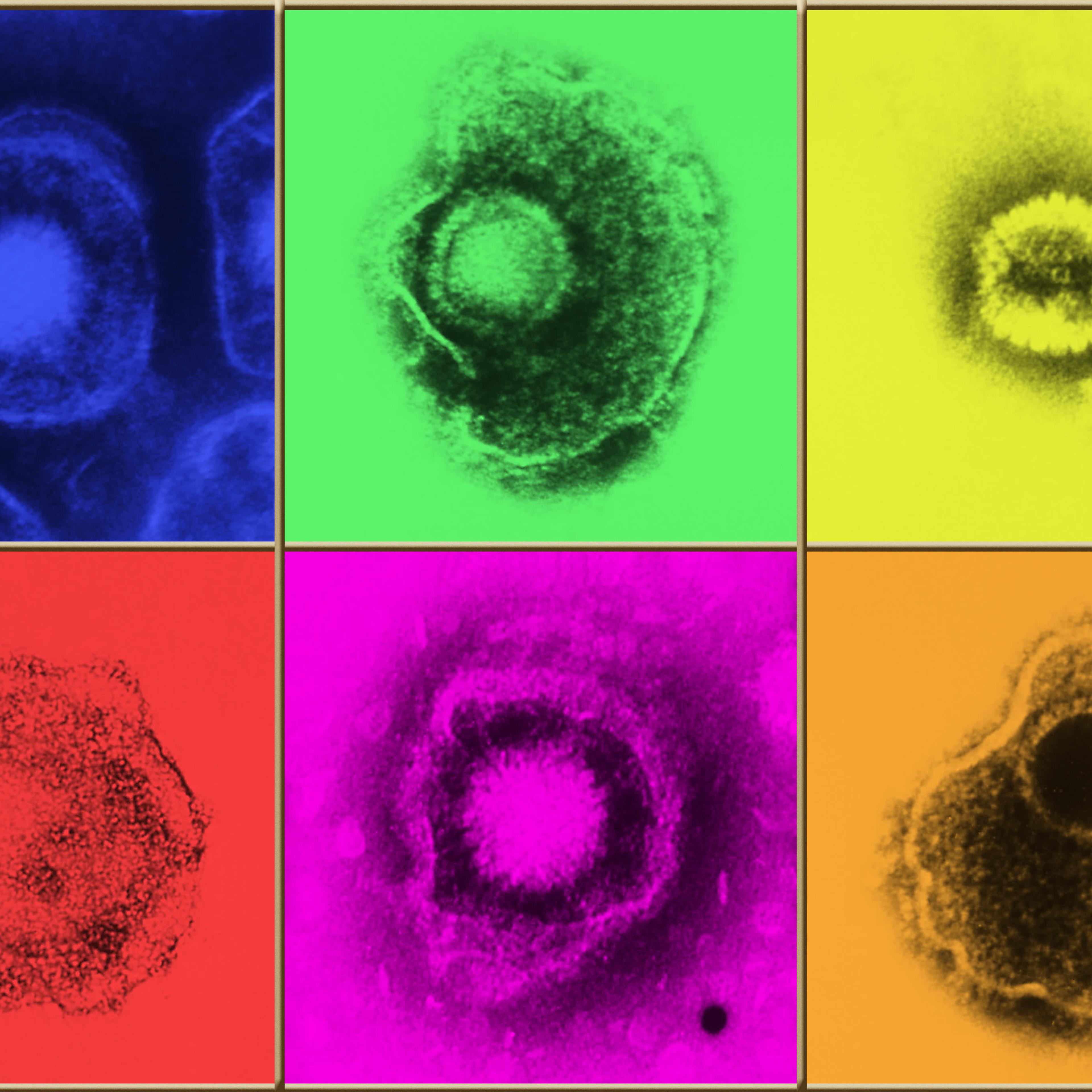 Herpes Virus